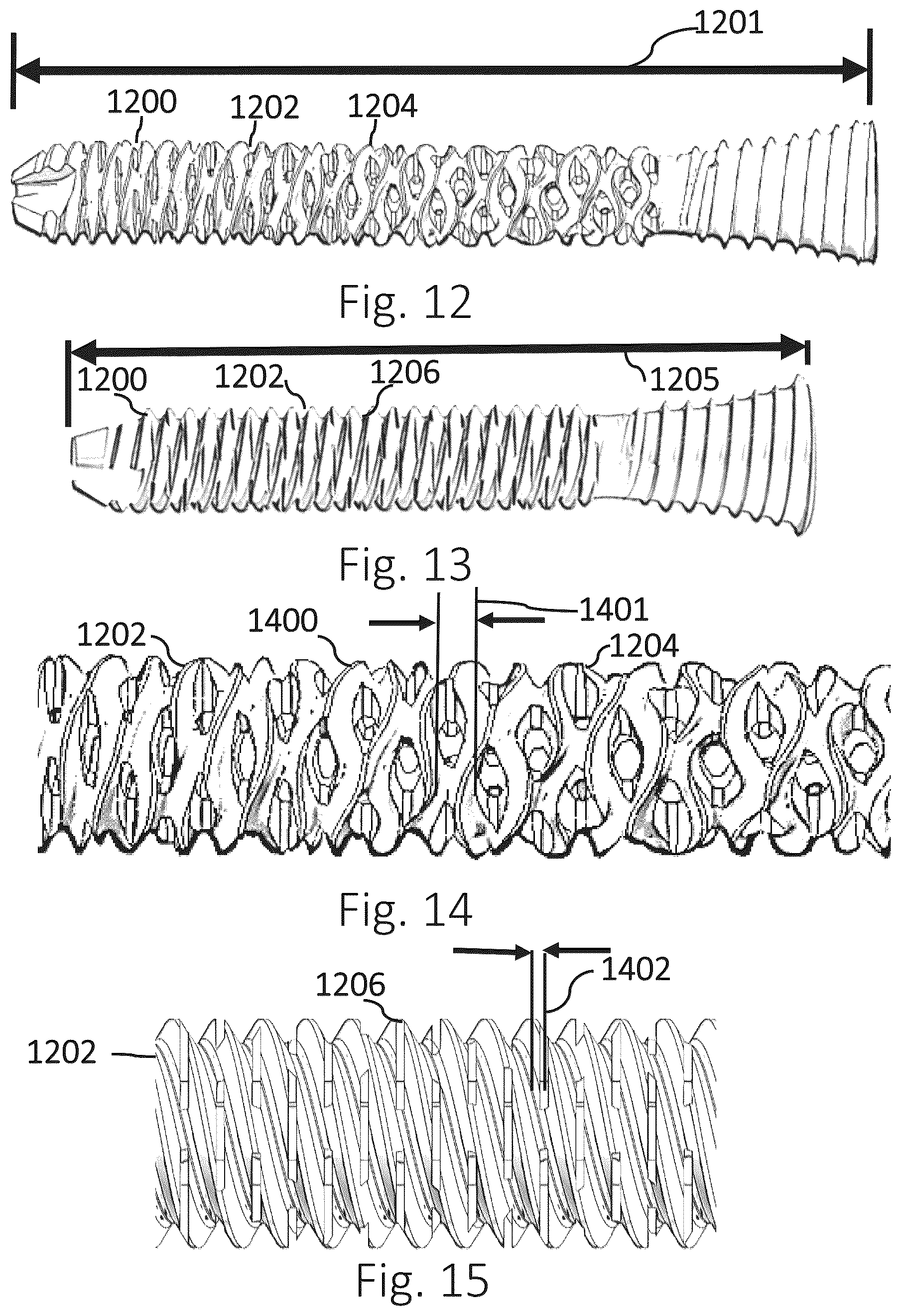 Patent US12426931 Figure 4 – Active compression apparatus, methods of assembly and methods of use