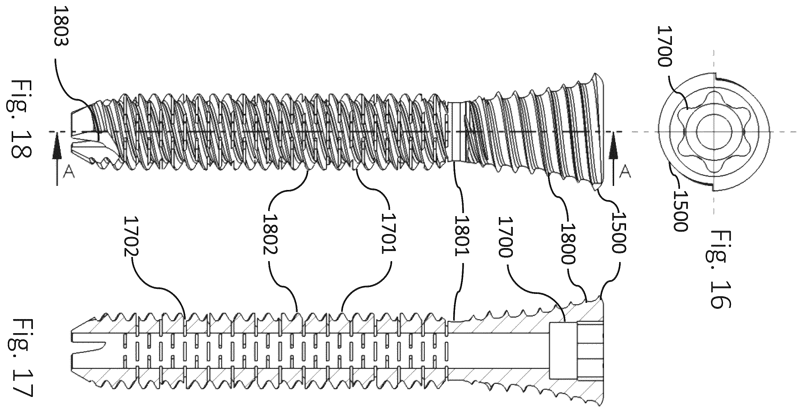 Patent US12426931 Figure 5 – Active compression apparatus, methods of assembly and methods of use