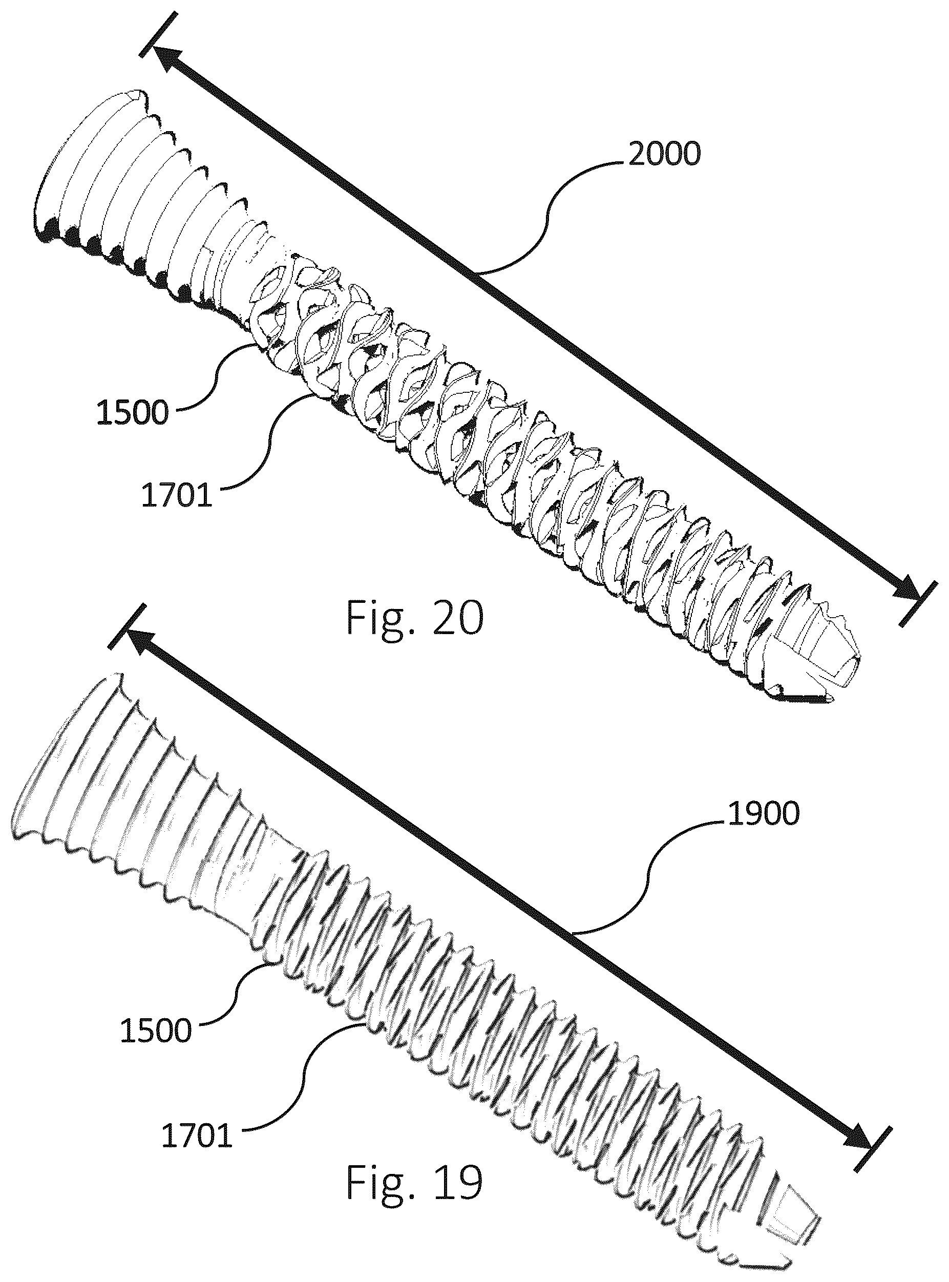Patent US12426931 Figure 6 – Active compression apparatus, methods of assembly and methods of use
