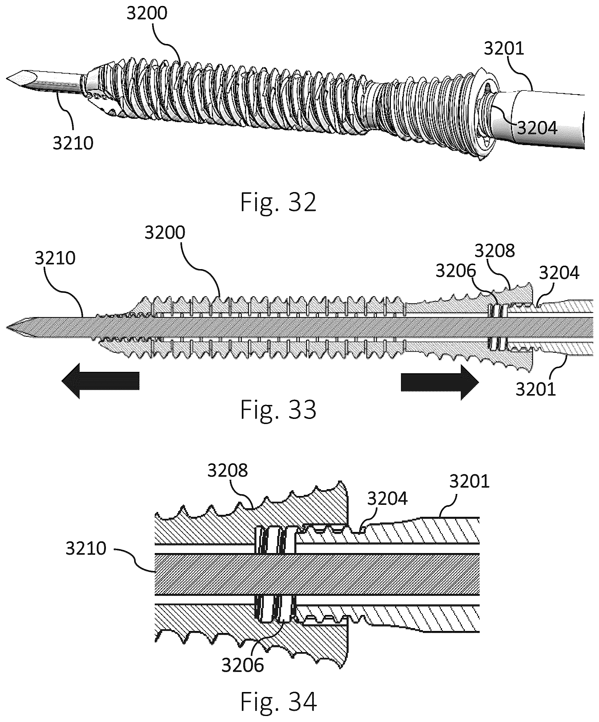 Patent US12426931 Figure 10 – Active compression apparatus, methods of assembly and methods of use