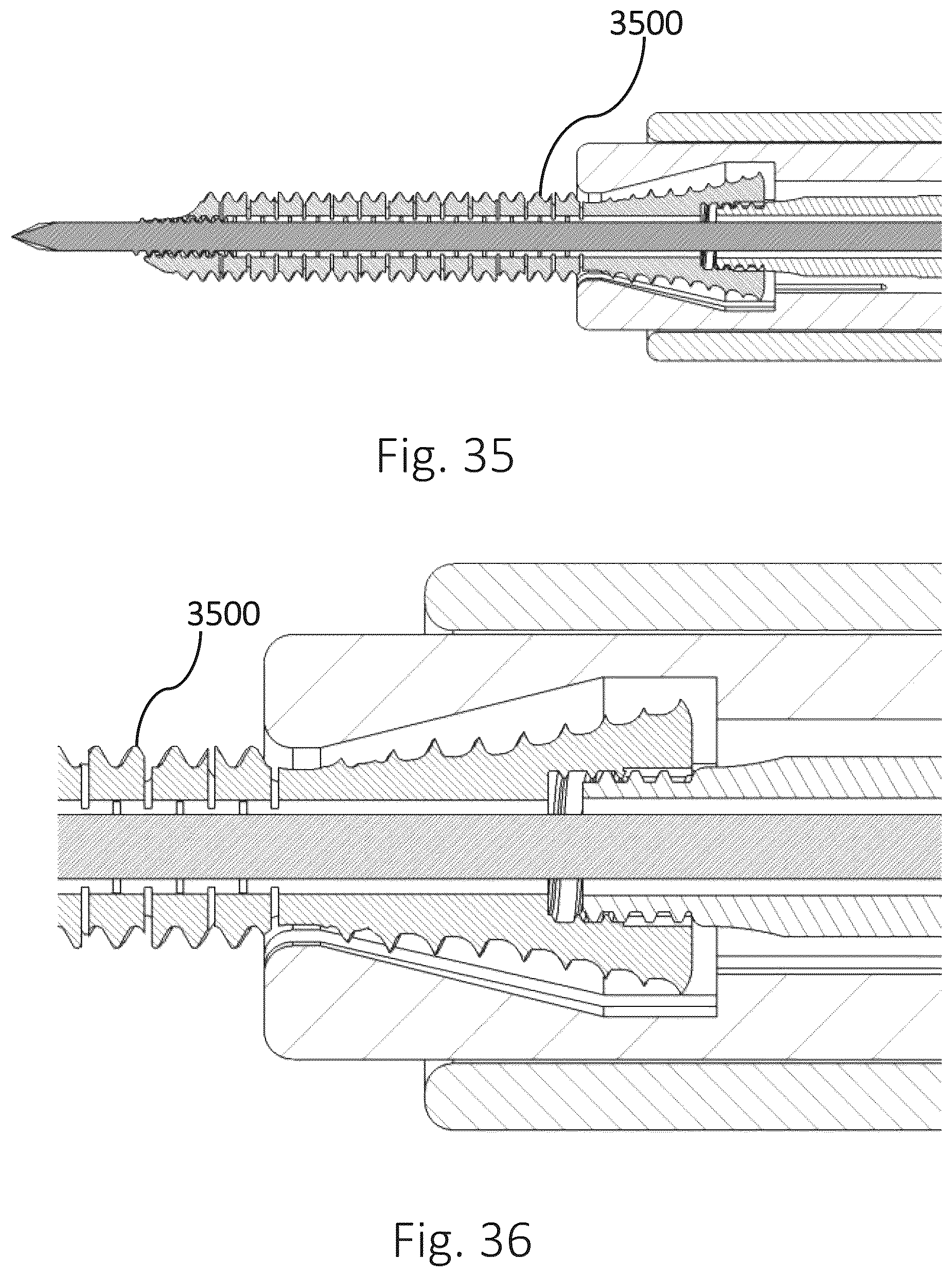 Patent US12426931 Figure 11 – Active compression apparatus, methods of assembly and methods of use