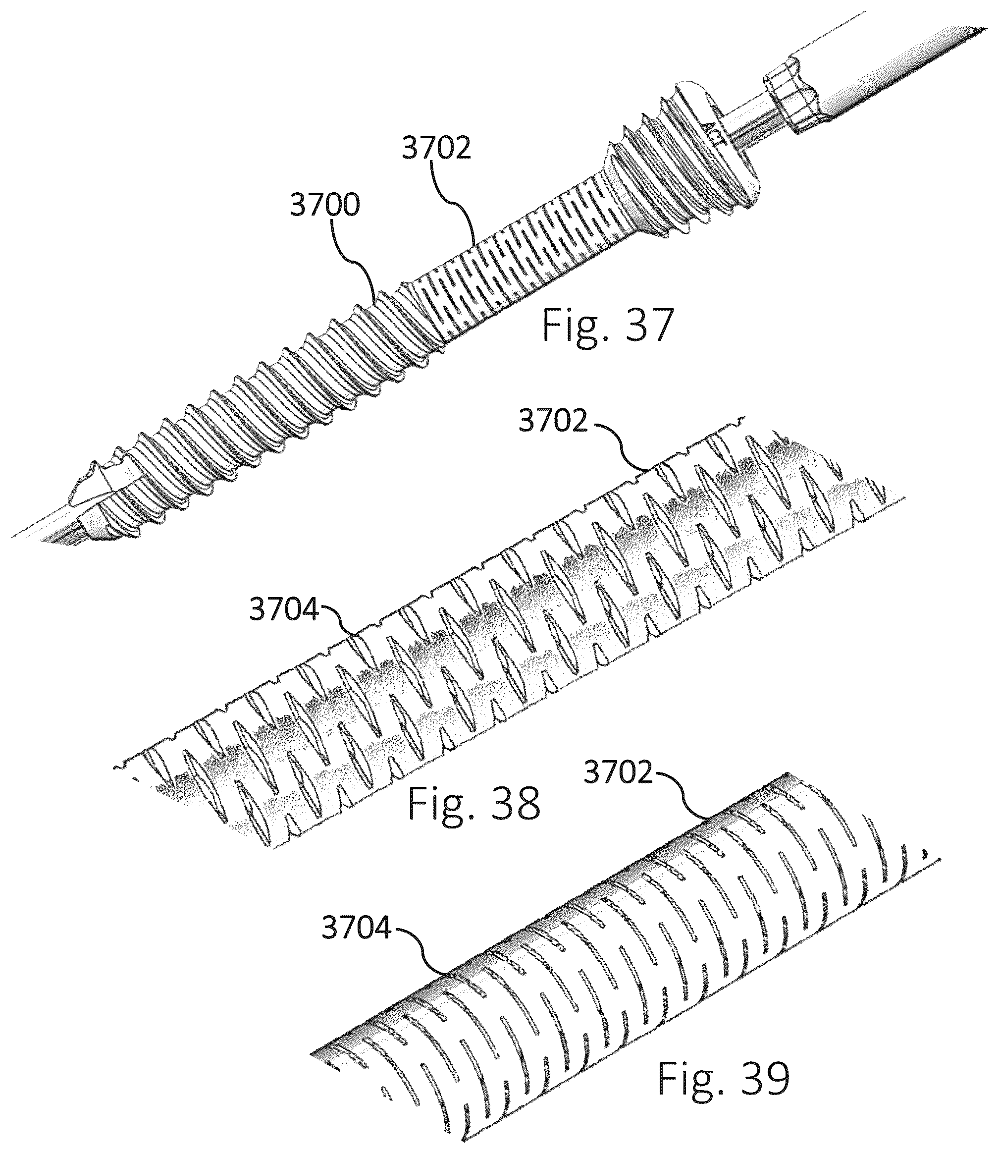 Patent US12426931 Figure 12 – Active compression apparatus, methods of assembly and methods of use