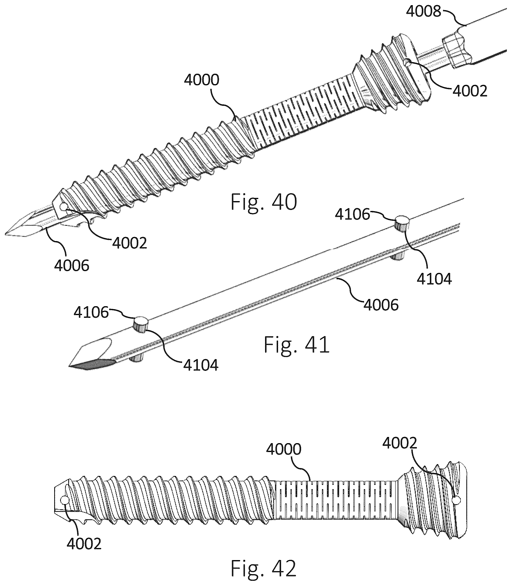 Patent US12426931 Figure 13 – Active compression apparatus, methods of assembly and methods of use