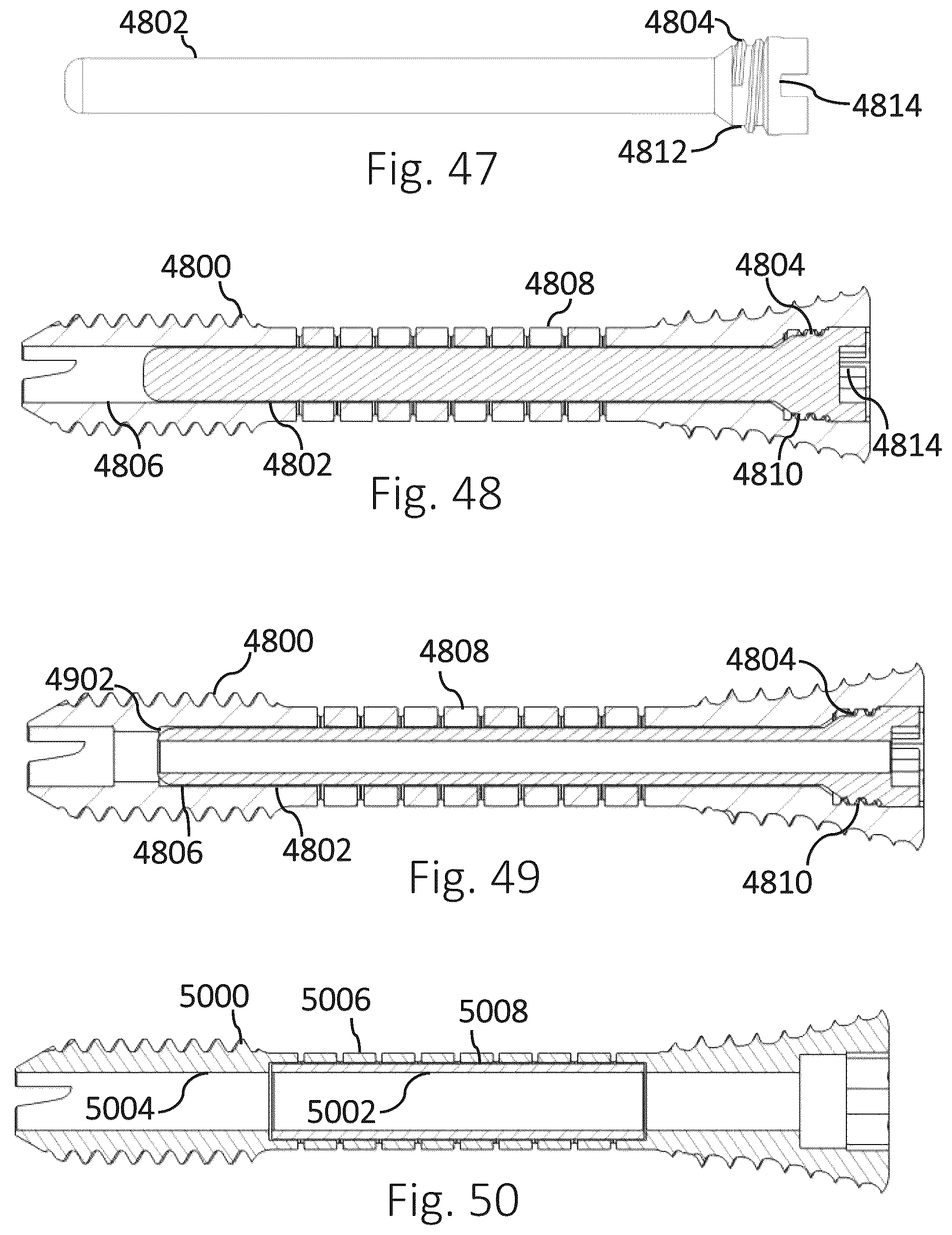 Patent US12426931 Figure 15 – Active compression apparatus, methods of assembly and methods of use