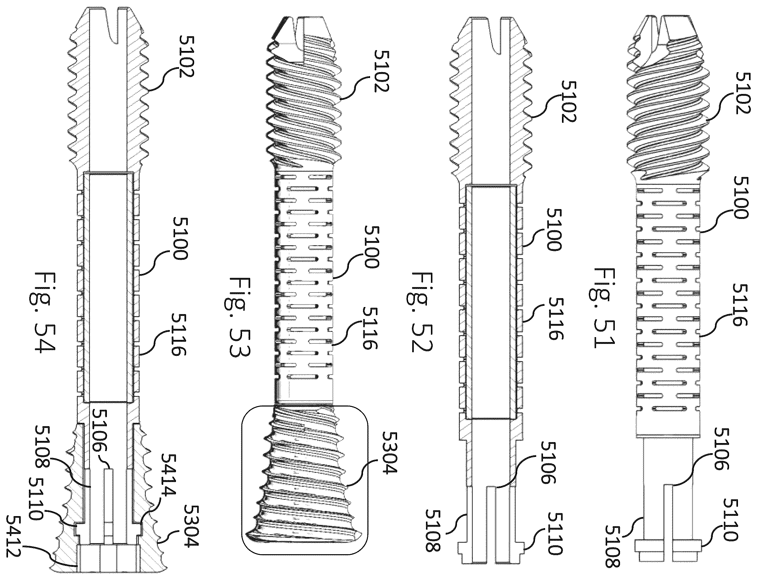 Patent US12426931 Figure 16 – Active compression apparatus, methods of assembly and methods of use