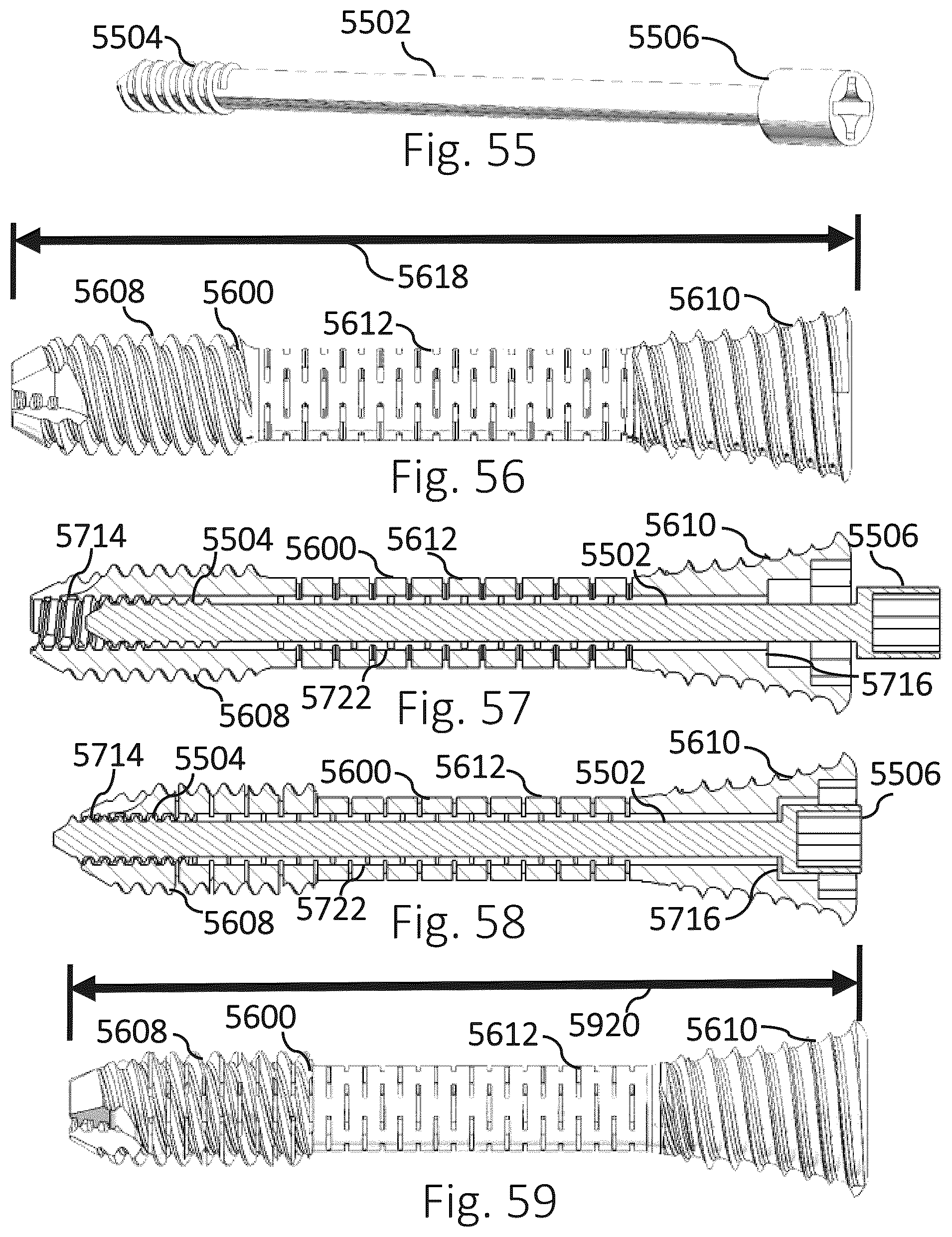 Patent US12426931 Figure 17 – Active compression apparatus, methods of assembly and methods of use