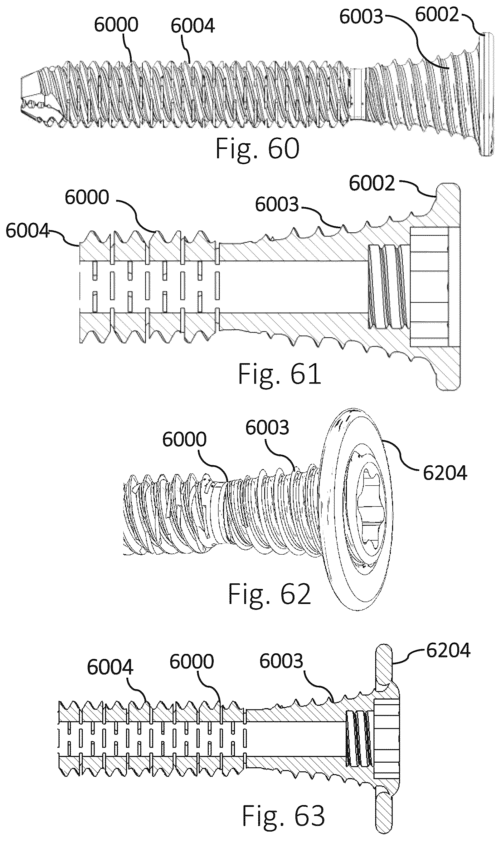 Patent US12426931 Figure 18 – Active compression apparatus, methods of assembly and methods of use