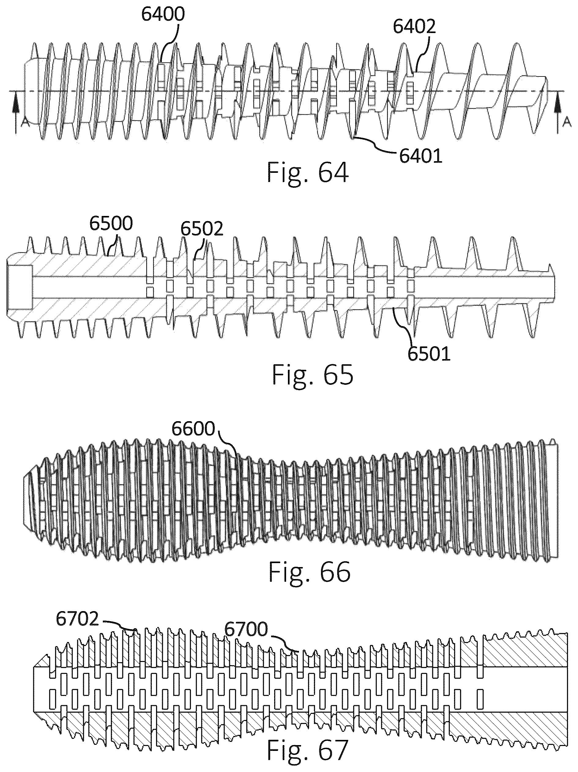 Patent US12426931 Figure 19 – Active compression apparatus, methods of assembly and methods of use