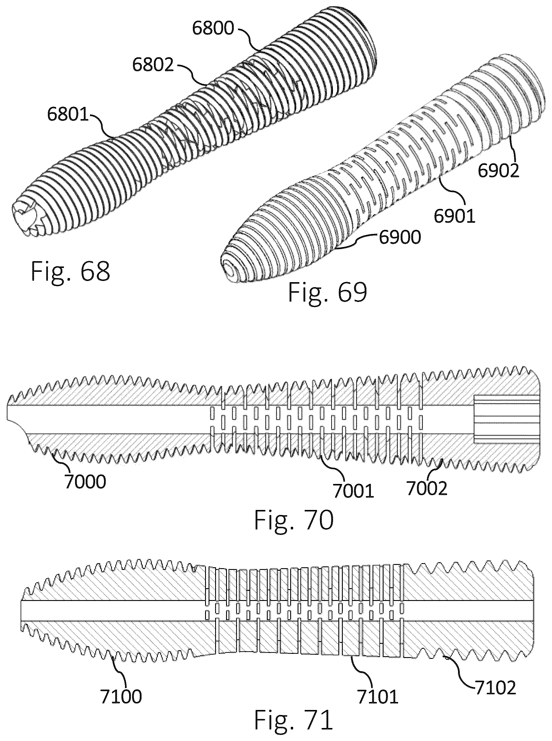 Patent US12426931 Figure 20 – Active compression apparatus, methods of assembly and methods of use