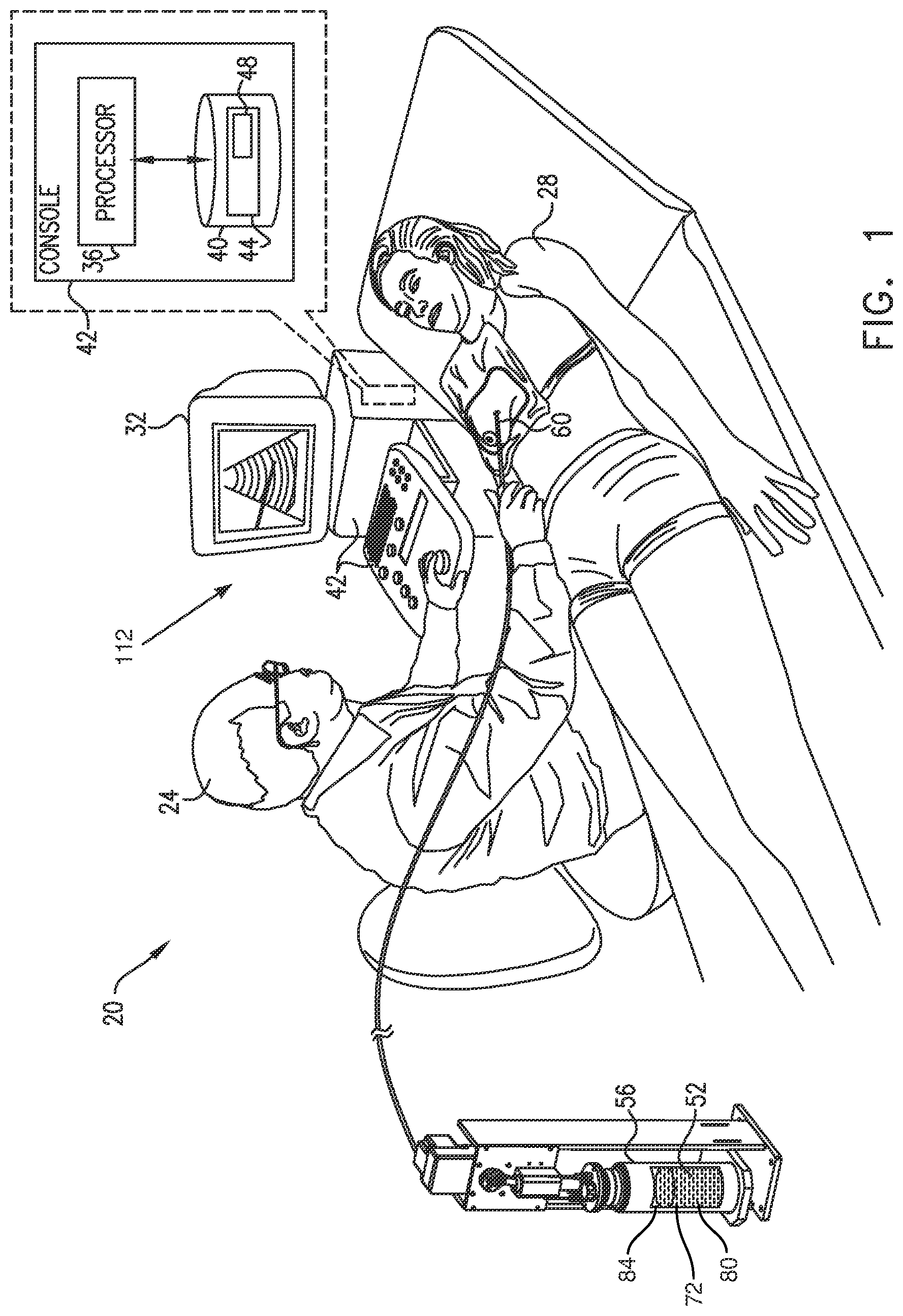 Patent US12426934 Figure 1 – Cryogen flow control