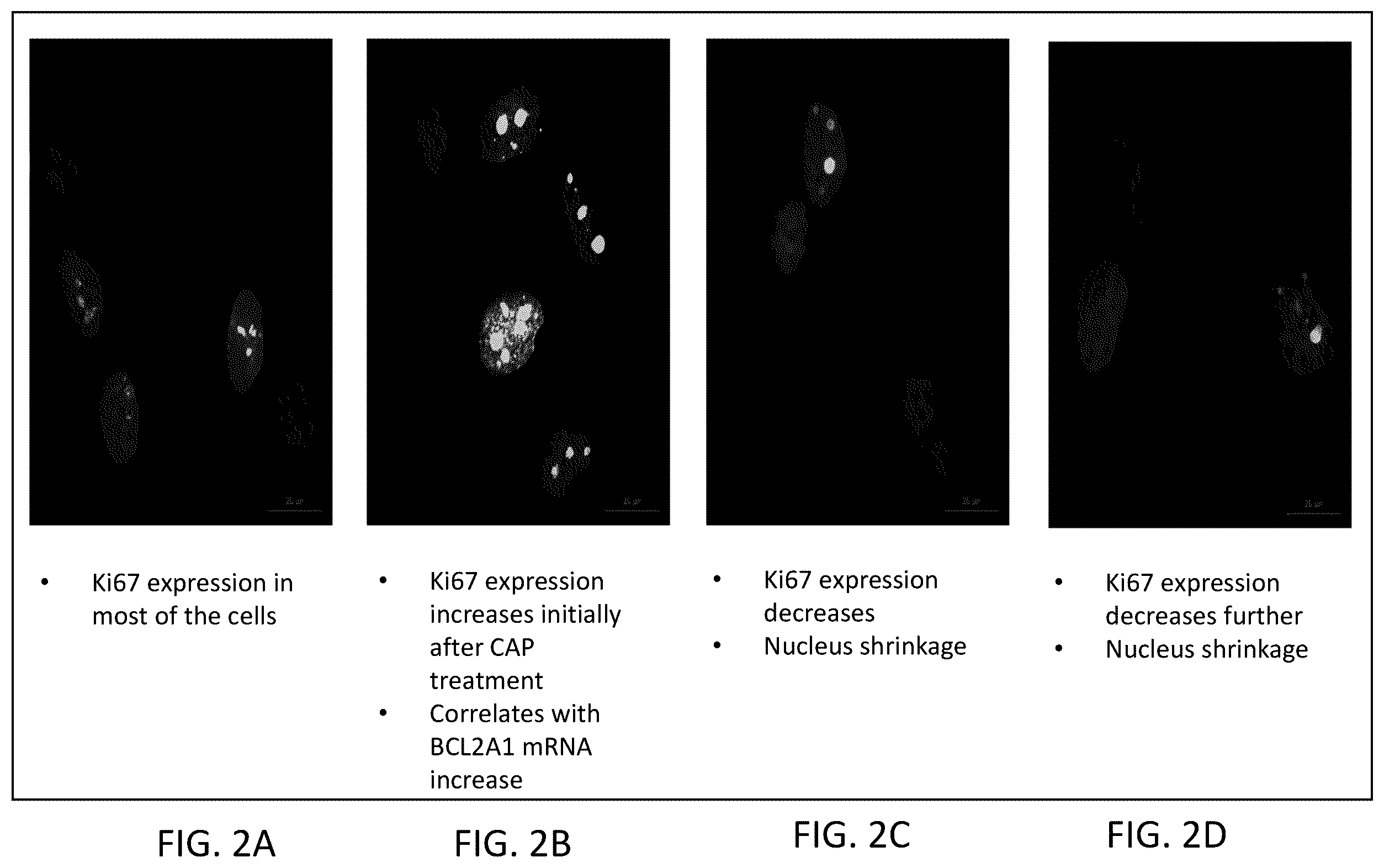 Patent US12426937 Figure 2 – System and method for suppressing apoe gene for sarcoma treatment