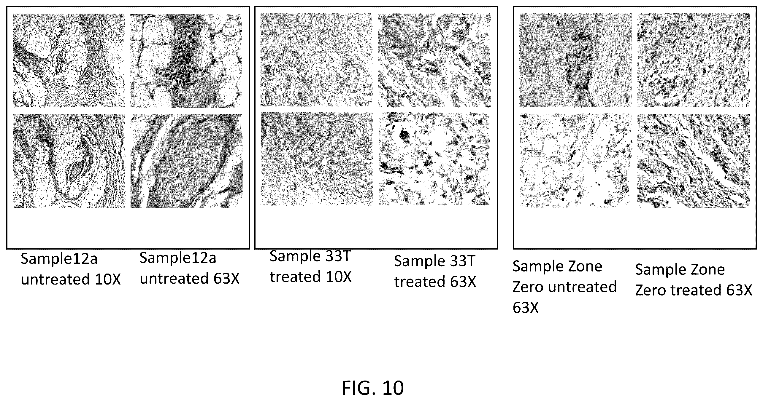 Patent US12426937 Figure 16 – System and method for suppressing apoe gene for sarcoma treatment