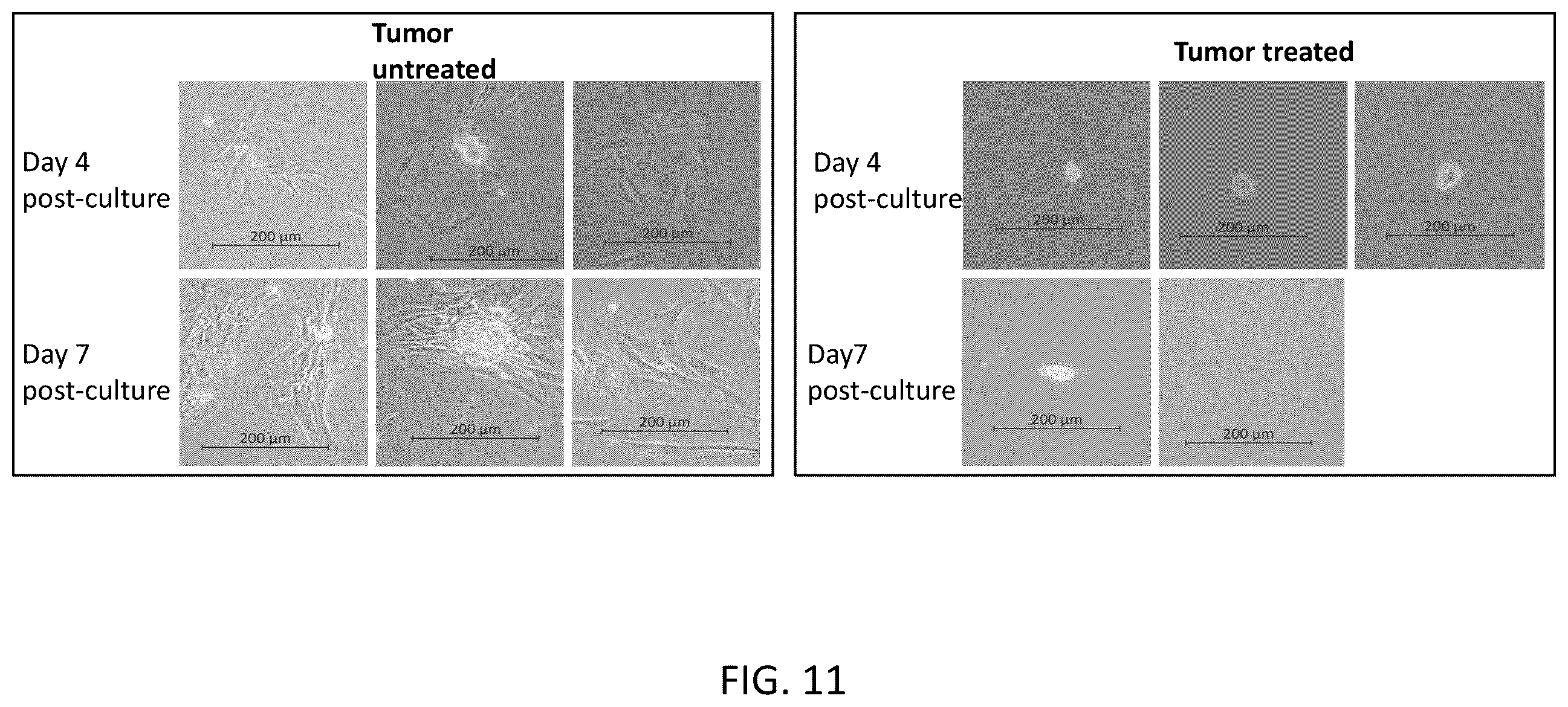 Patent US12426937 Figure 17 – System and method for suppressing apoe gene for sarcoma treatment
