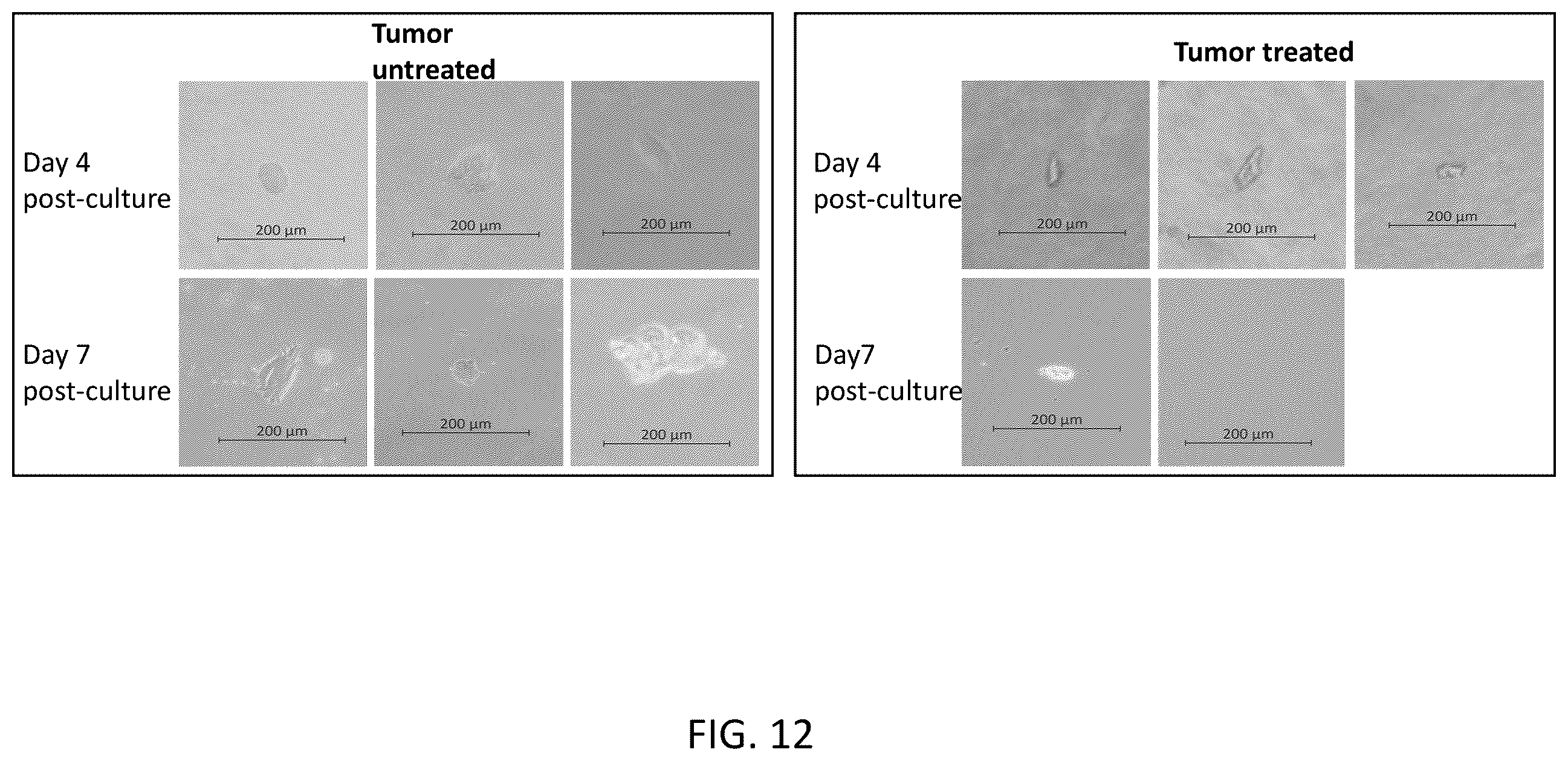 Patent US12426937 Figure 18 – System and method for suppressing apoe gene for sarcoma treatment