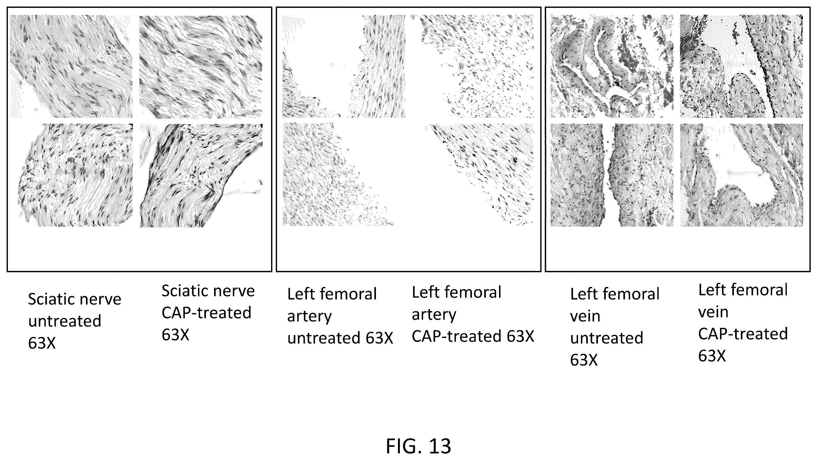 Patent US12426937 Figure 19 – System and method for suppressing apoe gene for sarcoma treatment