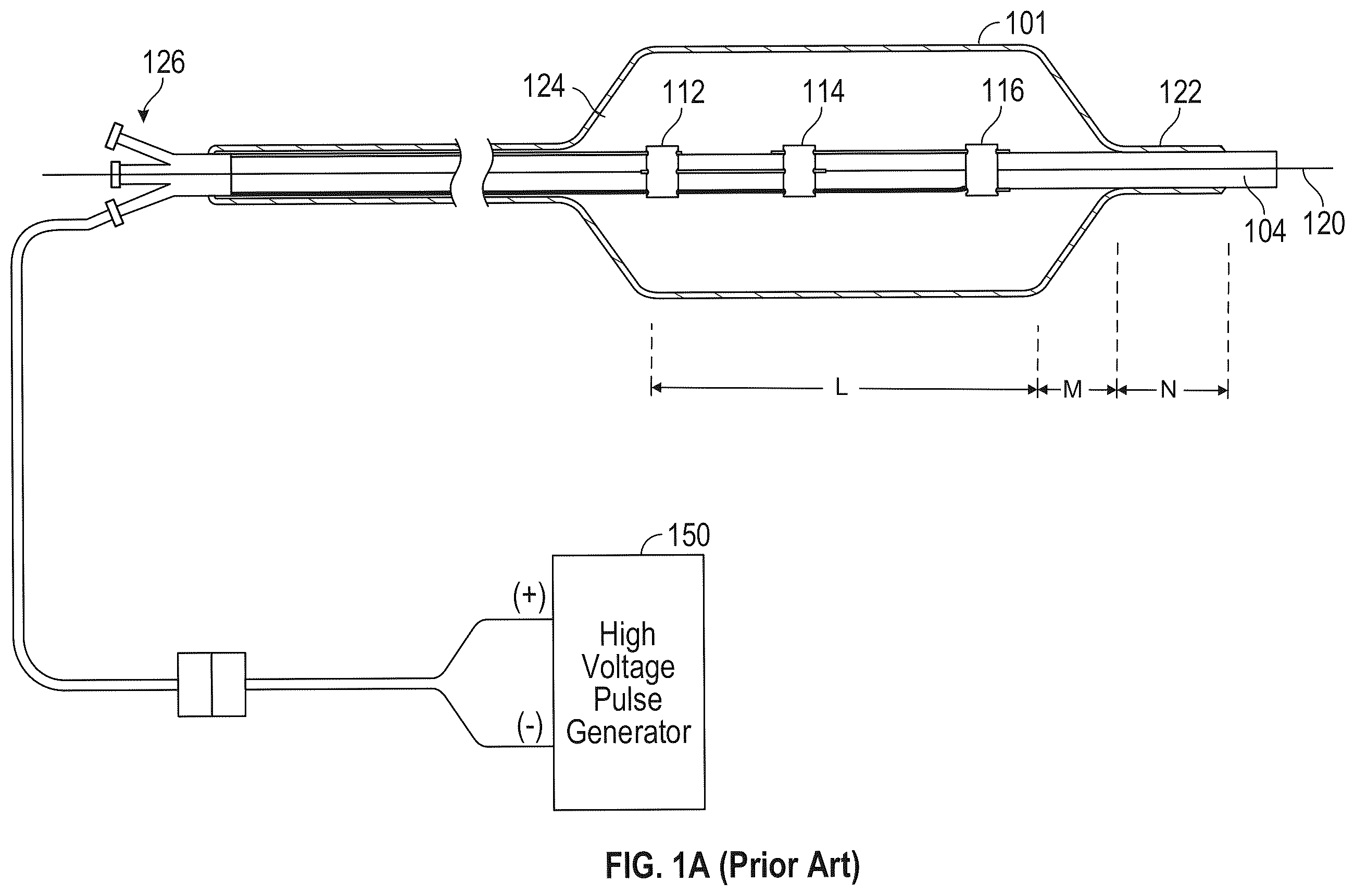 Patent US12426938 Figure 1 – Low profile electrodes for a shock wave catheter