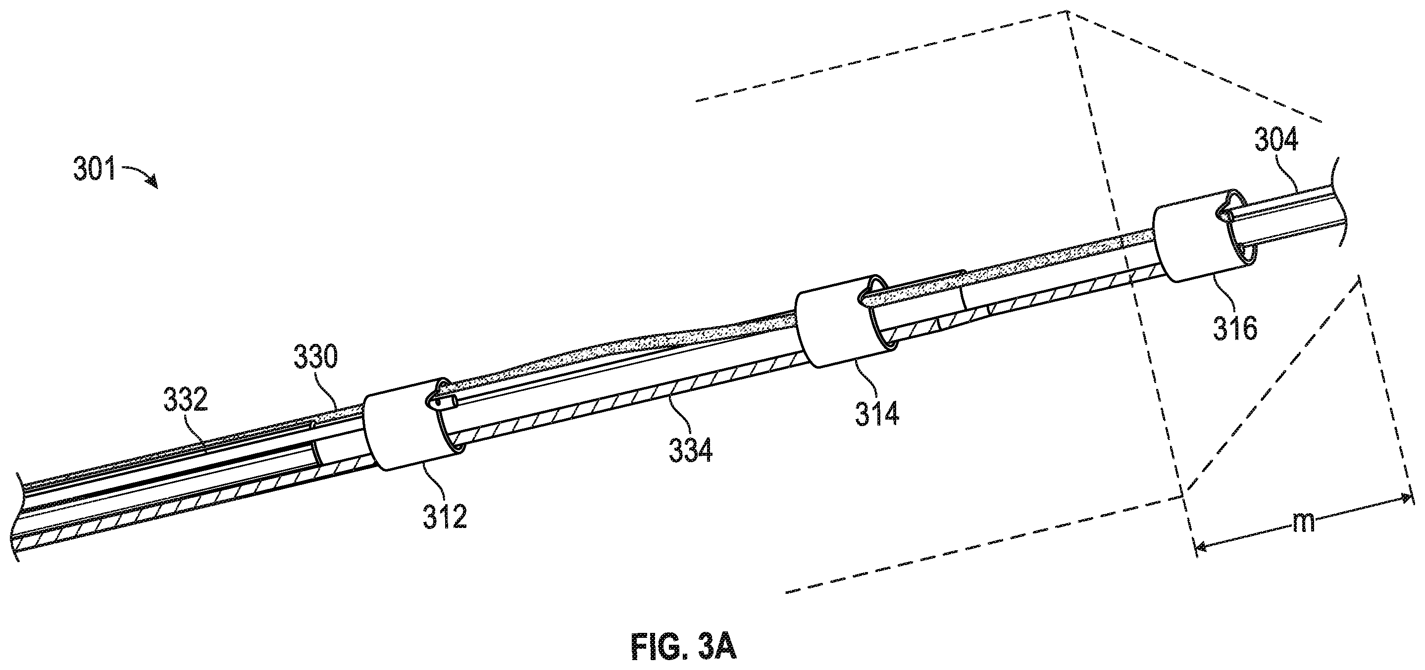 Patent US12426938 Figure 9 – Low profile electrodes for a shock wave catheter