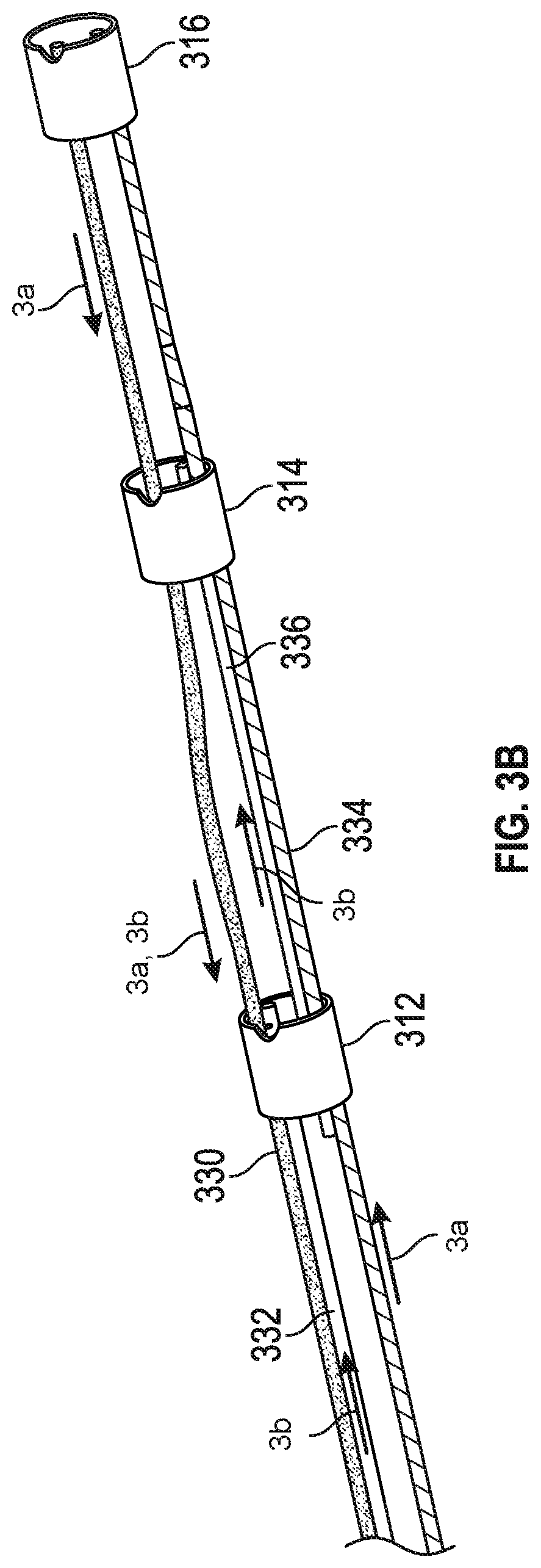 Patent US12426938 Figure 10 – Low profile electrodes for a shock wave catheter