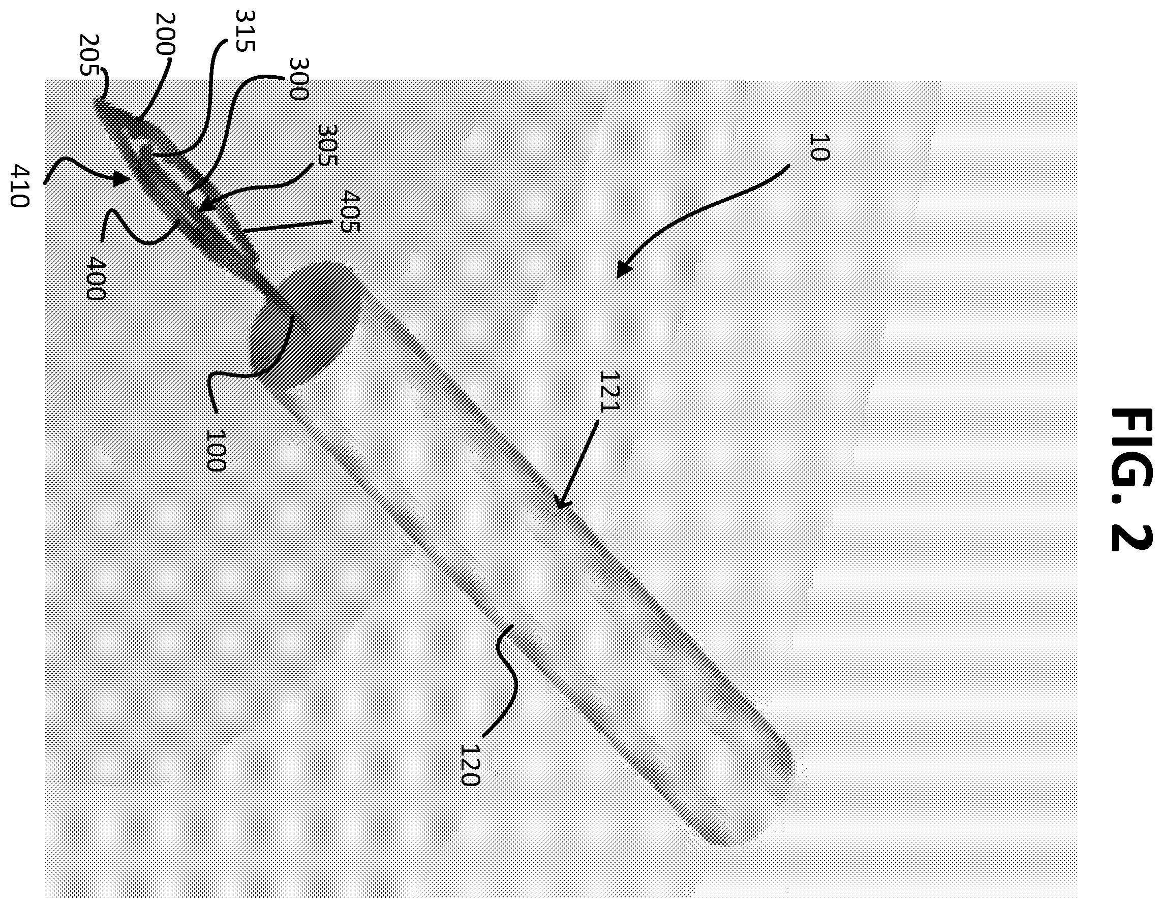Patent US12426939 Figure 2 – Micro-invasive surgical device and methods of use