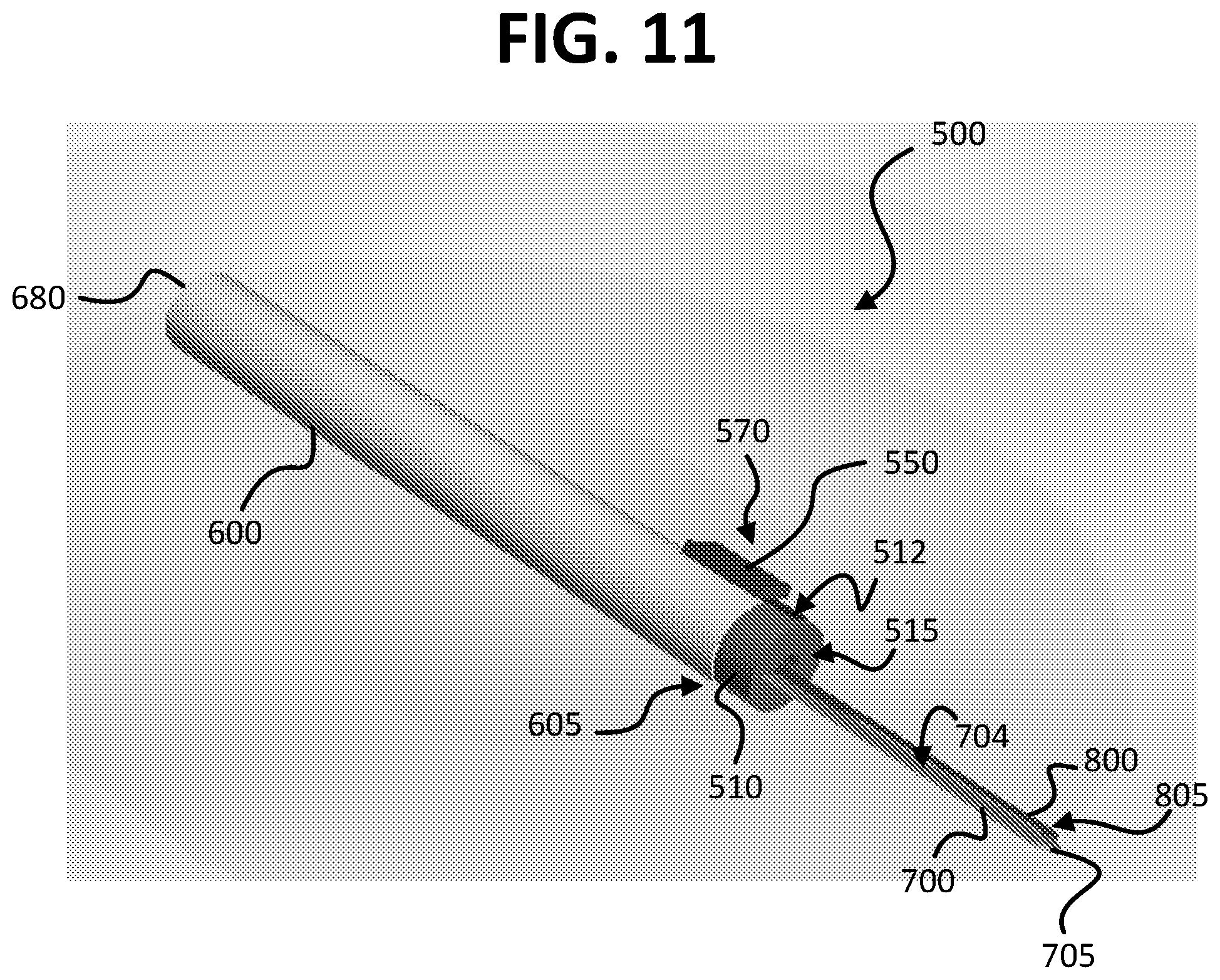 Patent US12426939 Figure 11 – Micro-invasive surgical device and methods of use