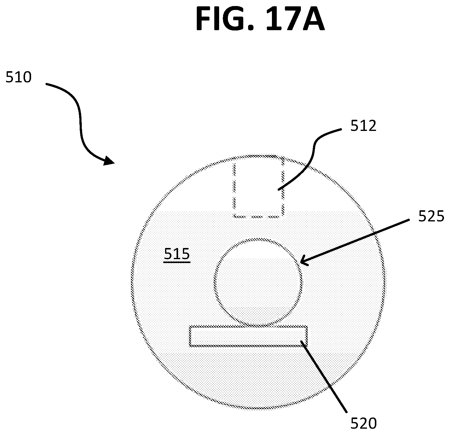 Patent US12426939 Figure 17 – Micro-invasive surgical device and methods of use