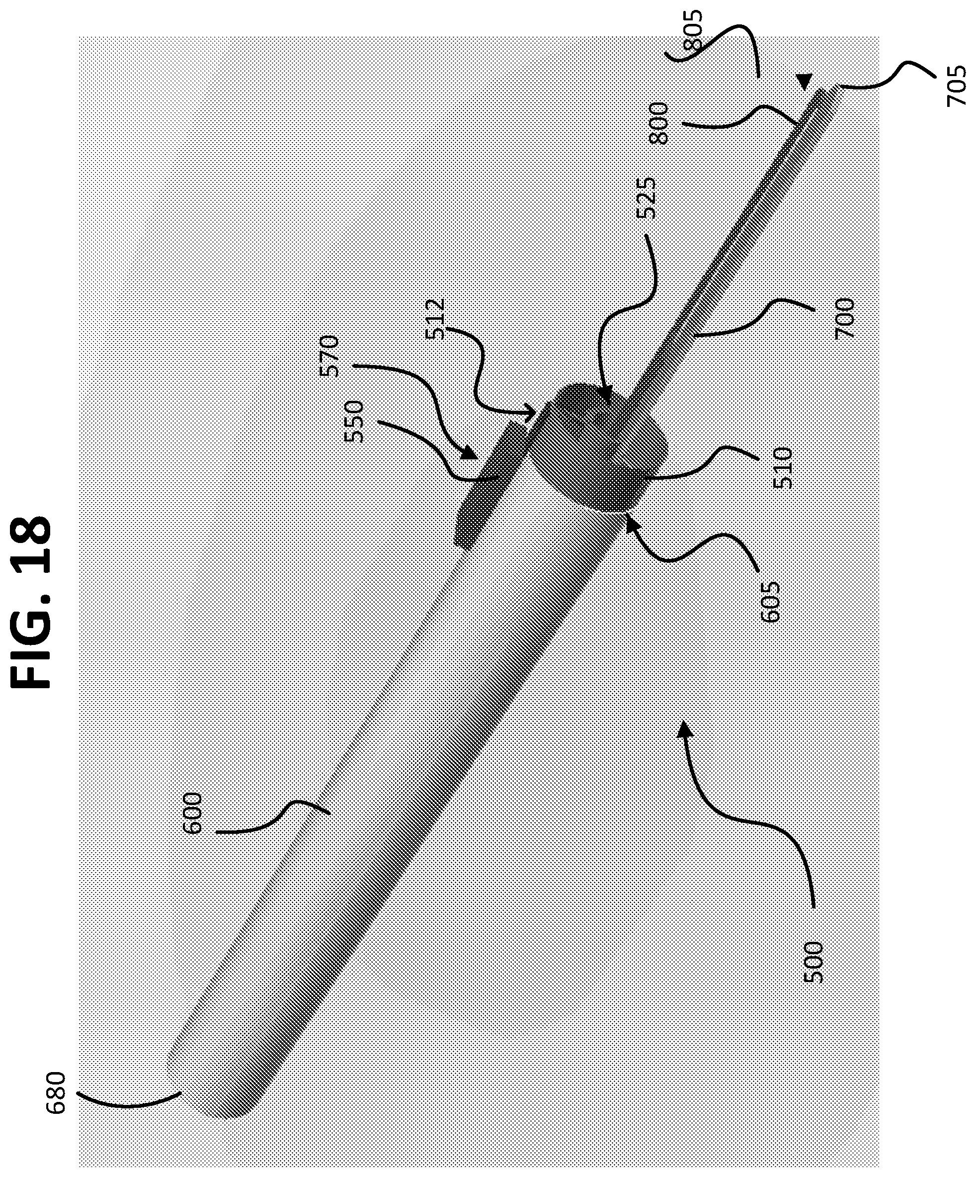 Patent US12426939 Figure 19 – Micro-invasive surgical device and methods of use