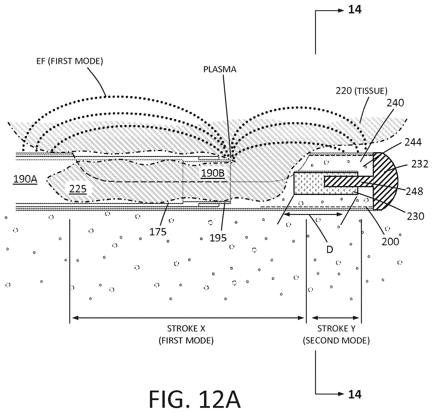 Patent US12426943 Figure 11 – Tissue extraction devices and methods