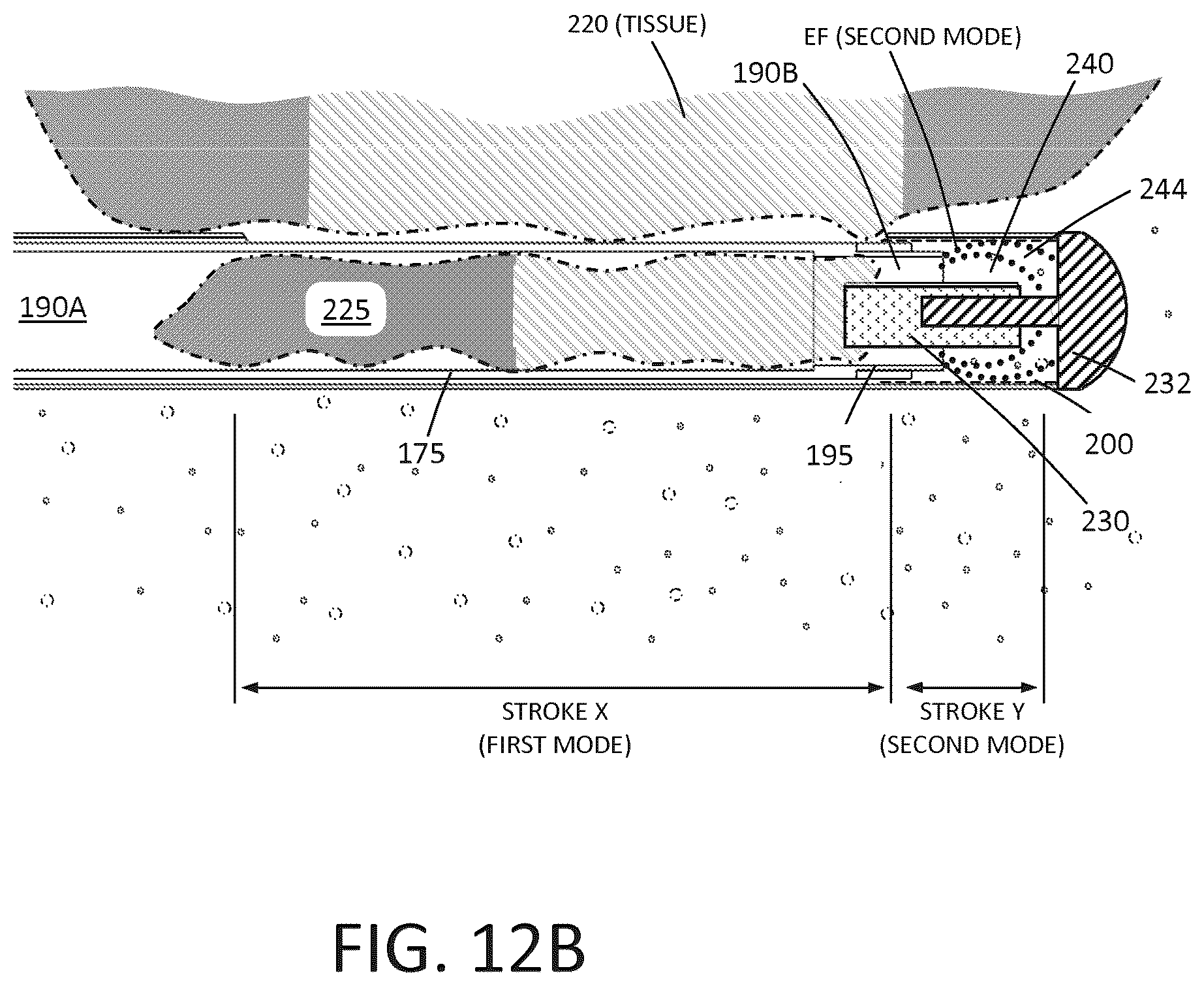 Patent US12426943 Figure 12 – Tissue extraction devices and methods