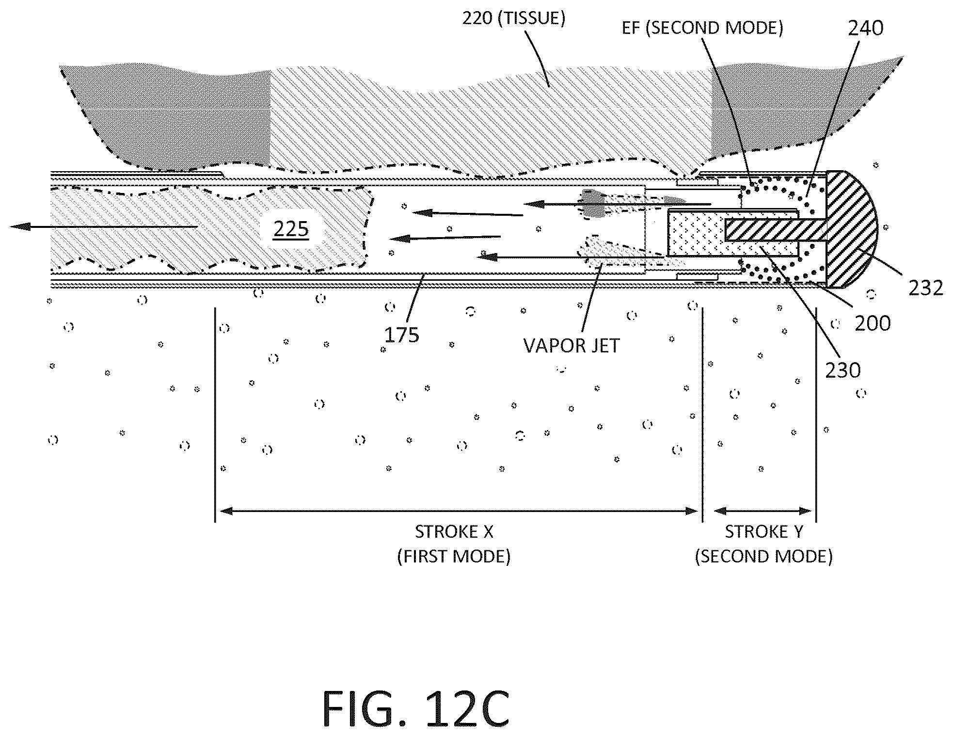 Patent US12426943 Figure 13 – Tissue extraction devices and methods
