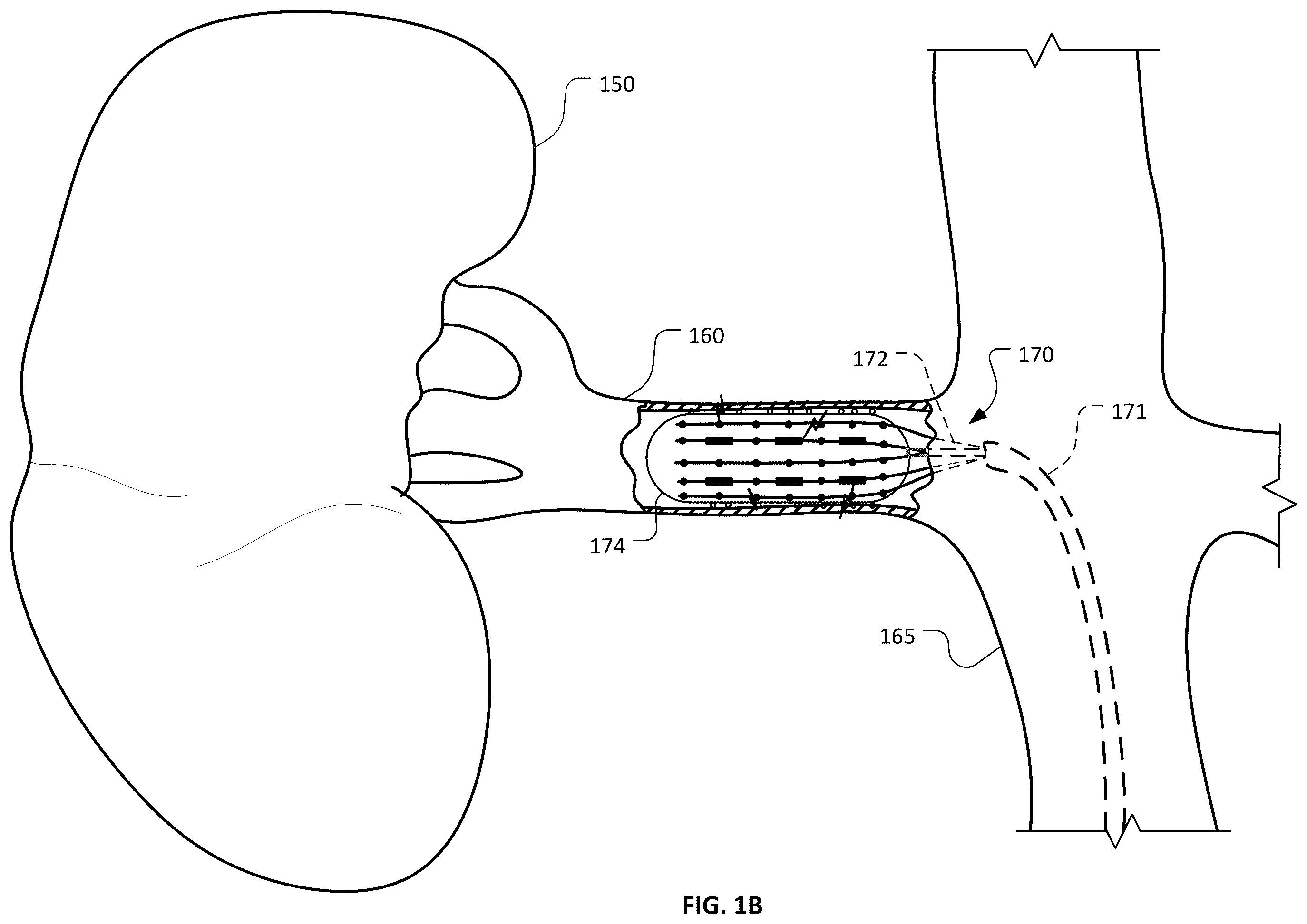 Patent US12426947 Figure 2 – Devices and methods for ablation of tissue