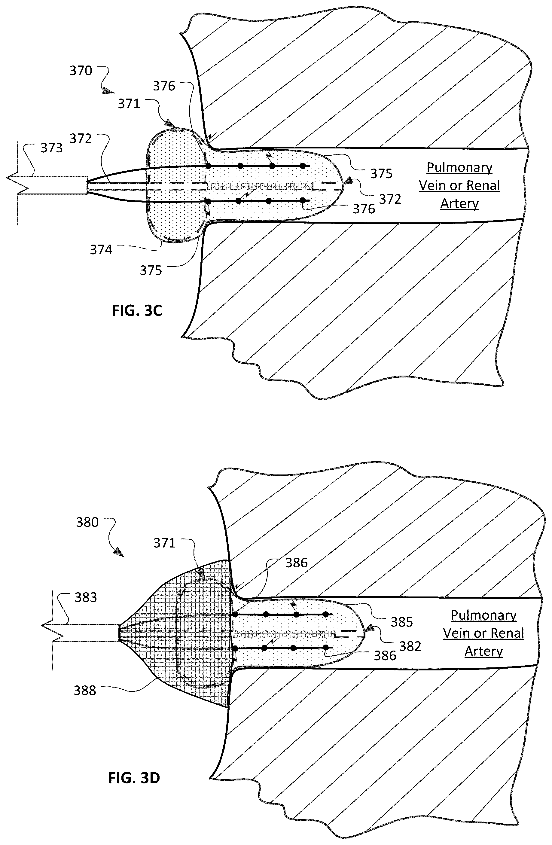 Patent US12426947 Figure 6 – Devices and methods for ablation of tissue