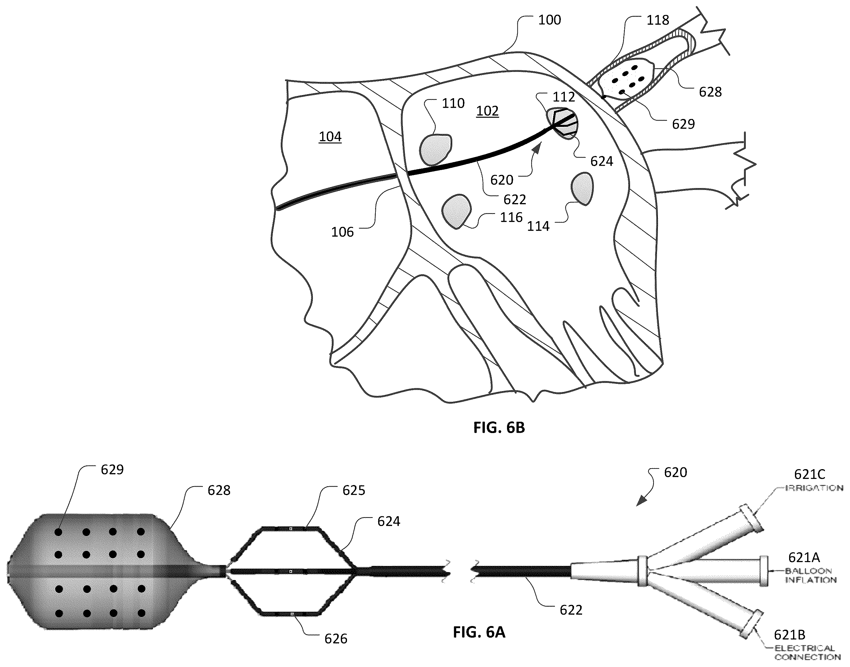 Patent US12426947 Figure 9 – Devices and methods for ablation of tissue