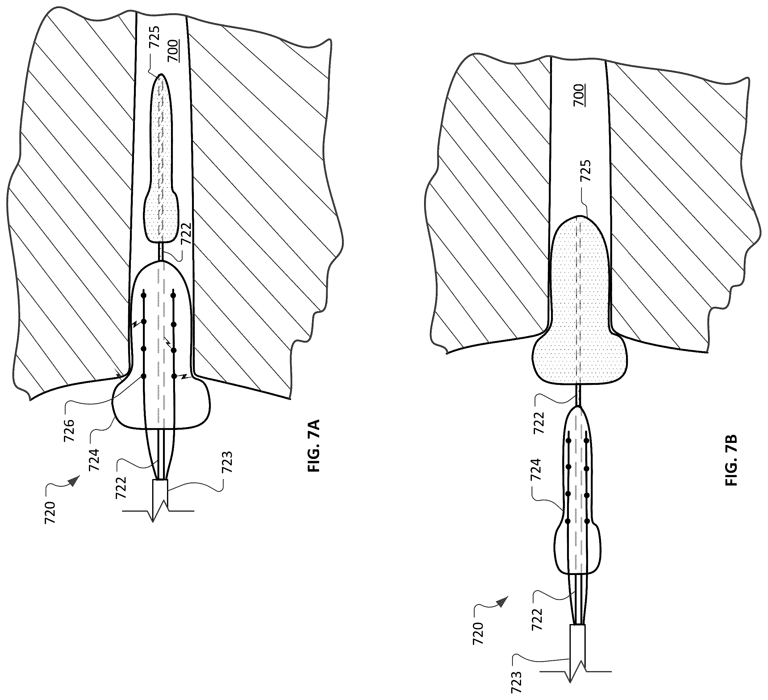Patent US12426947 Figure 10 – Devices and methods for ablation of tissue