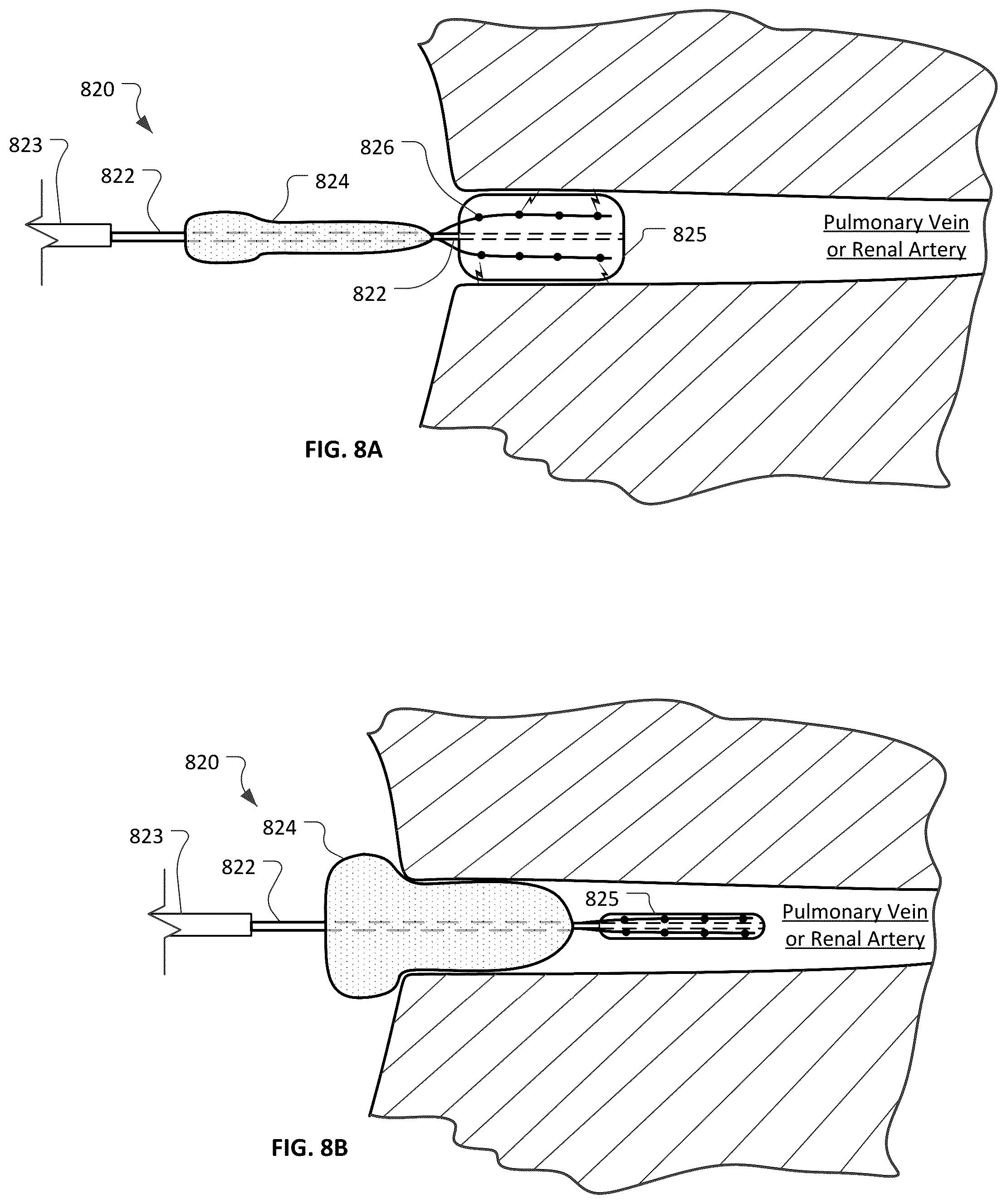 Patent US12426947 Figure 11 – Devices and methods for ablation of tissue