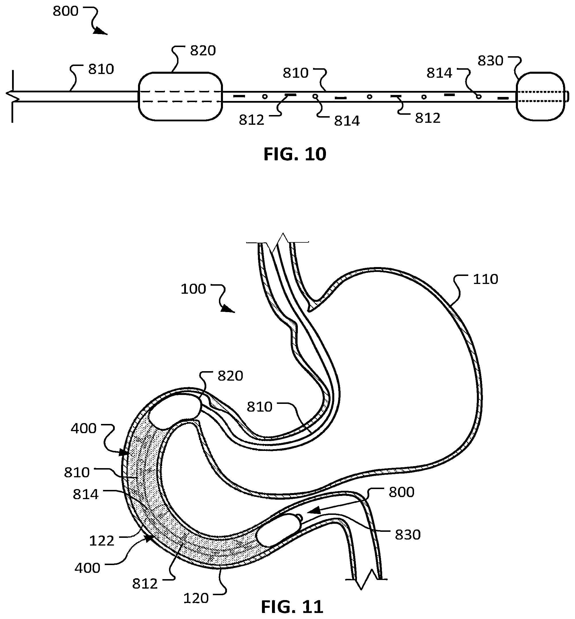 Patent US12426948 Figure 7 – Electroporation for obesity or diabetes treatment