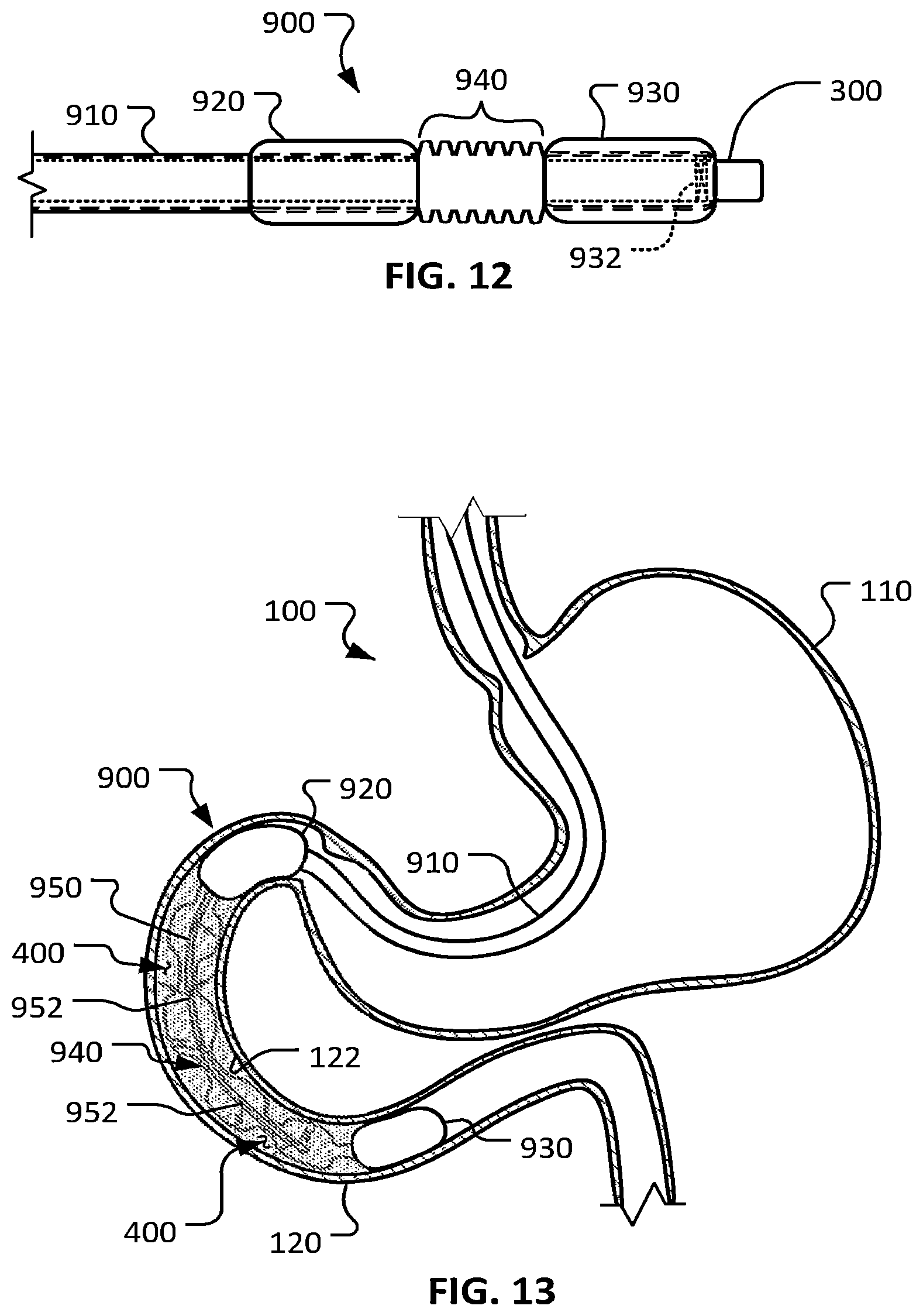 Patent US12426948 Figure 8 – Electroporation for obesity or diabetes treatment