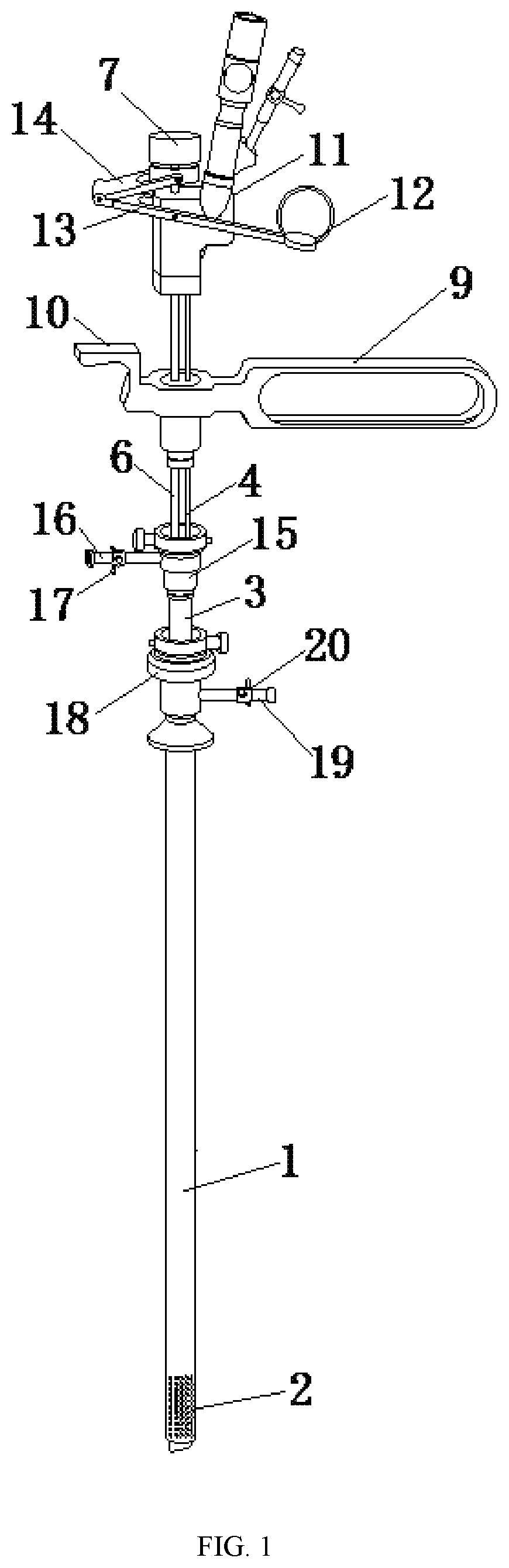 Patent US12426950 Figure 1 – Laser resectoscope for minor caliber