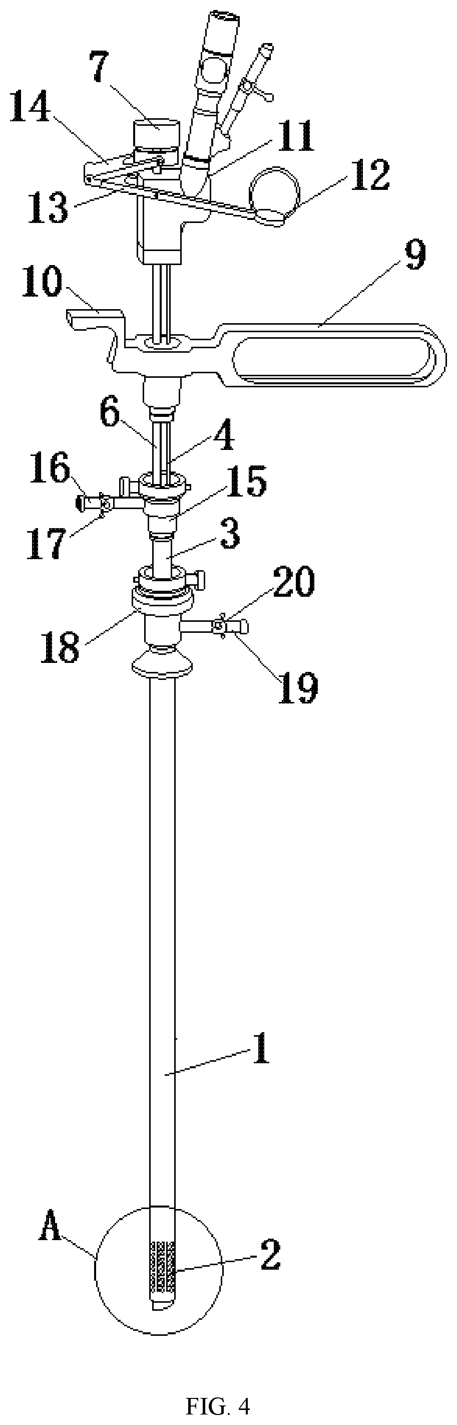 Patent US12426950 Figure 4 – Laser resectoscope for minor caliber