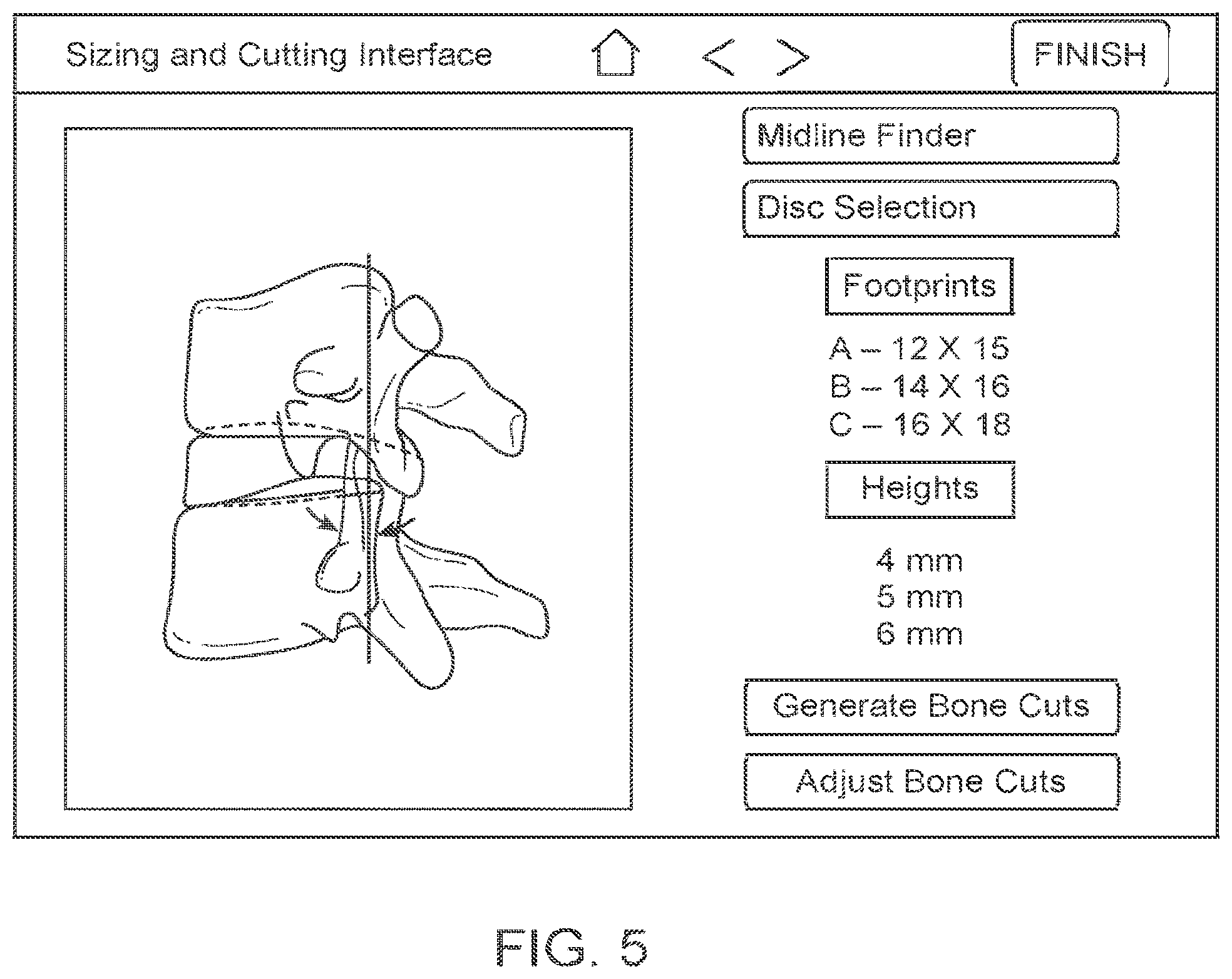 Patent US12426951 Figure 4 – Robotic system and method for bone preparation for intervertebral disc prosthesis implantation
