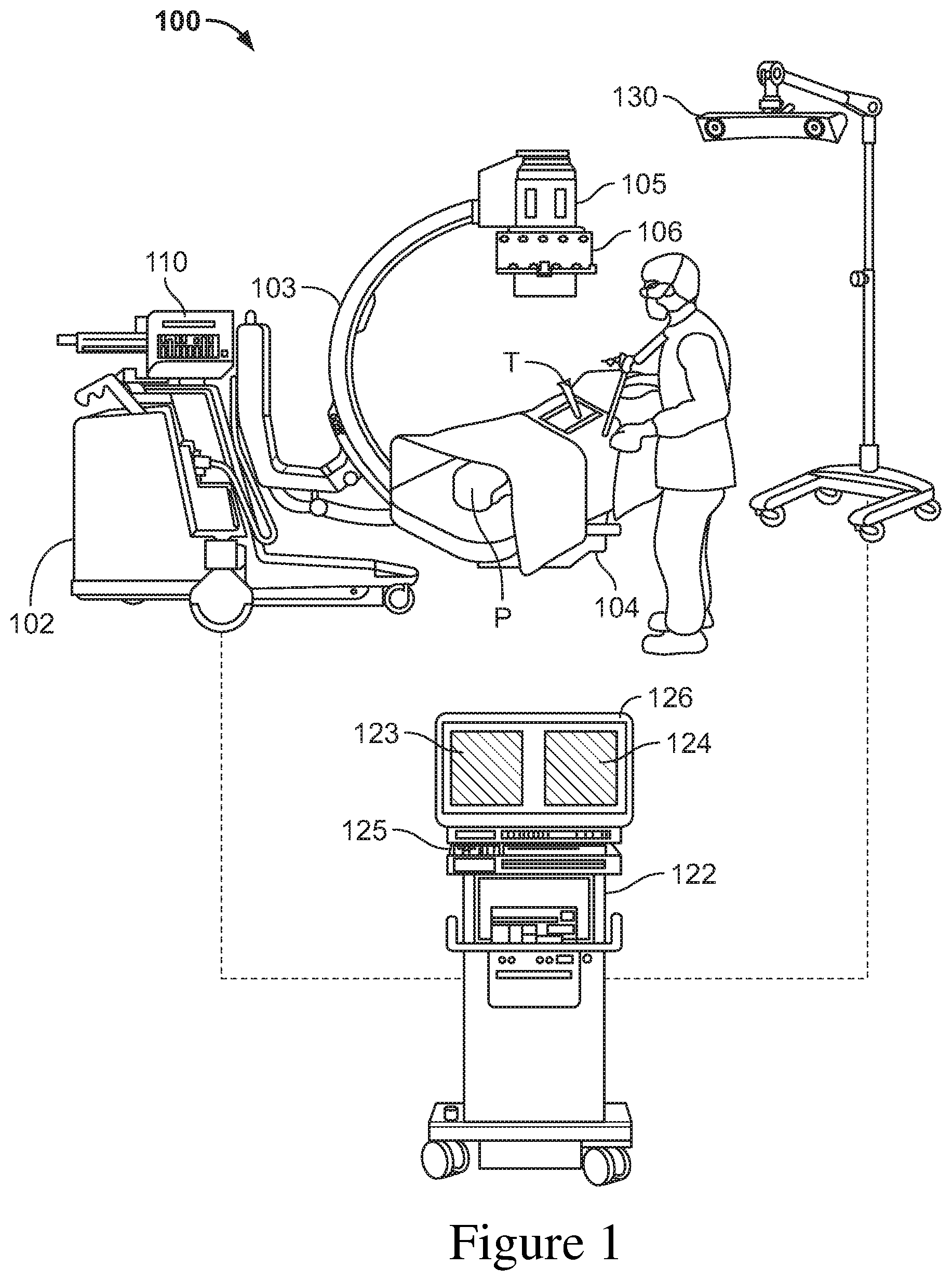 Patent US12426952 Figure 1 – Prediction of postoperative global sagittal alignment based on full-body musculoskeletal modeling and posture optimization