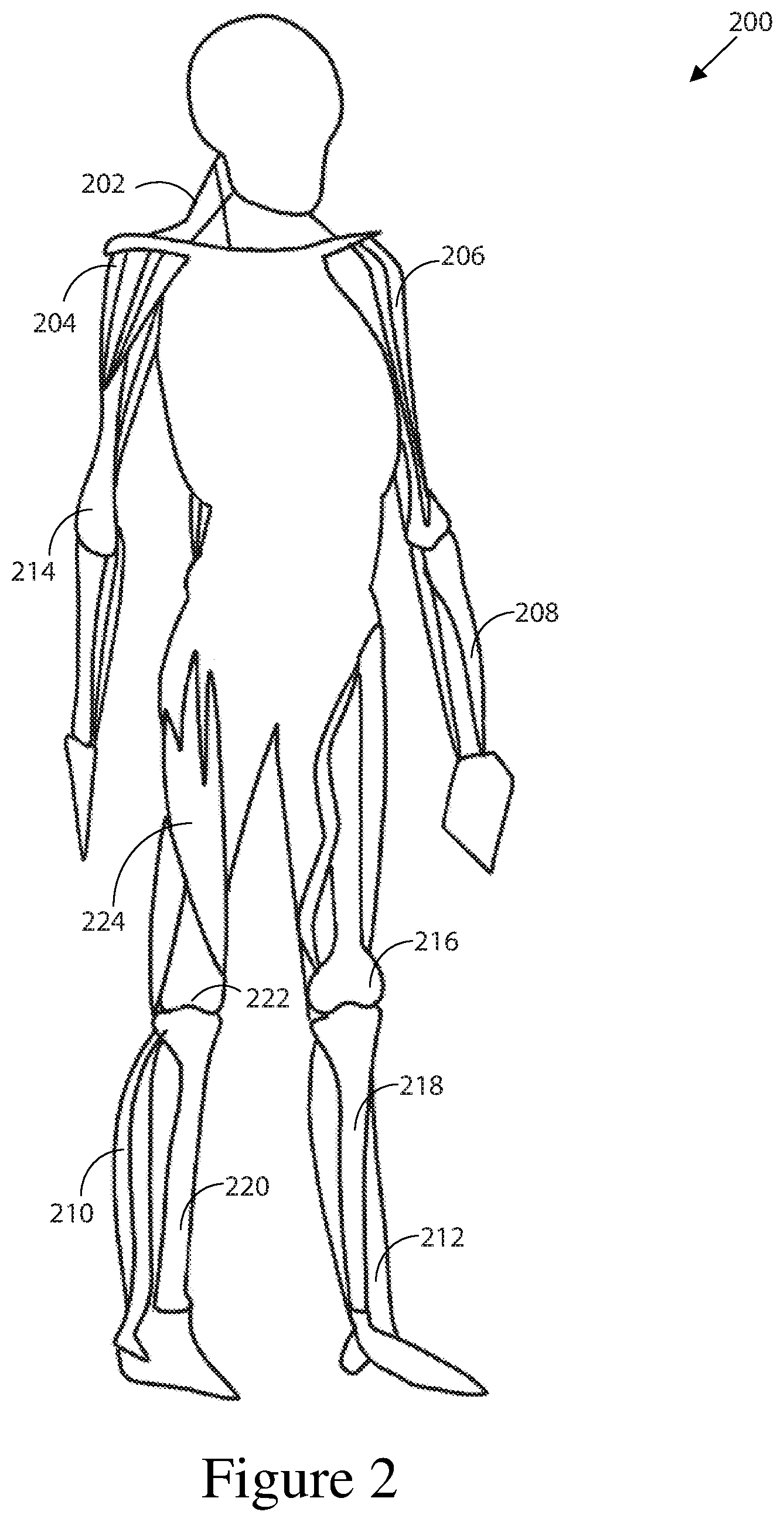 Patent US12426952 Figure 2 – Prediction of postoperative global sagittal alignment based on full-body musculoskeletal modeling and posture optimization