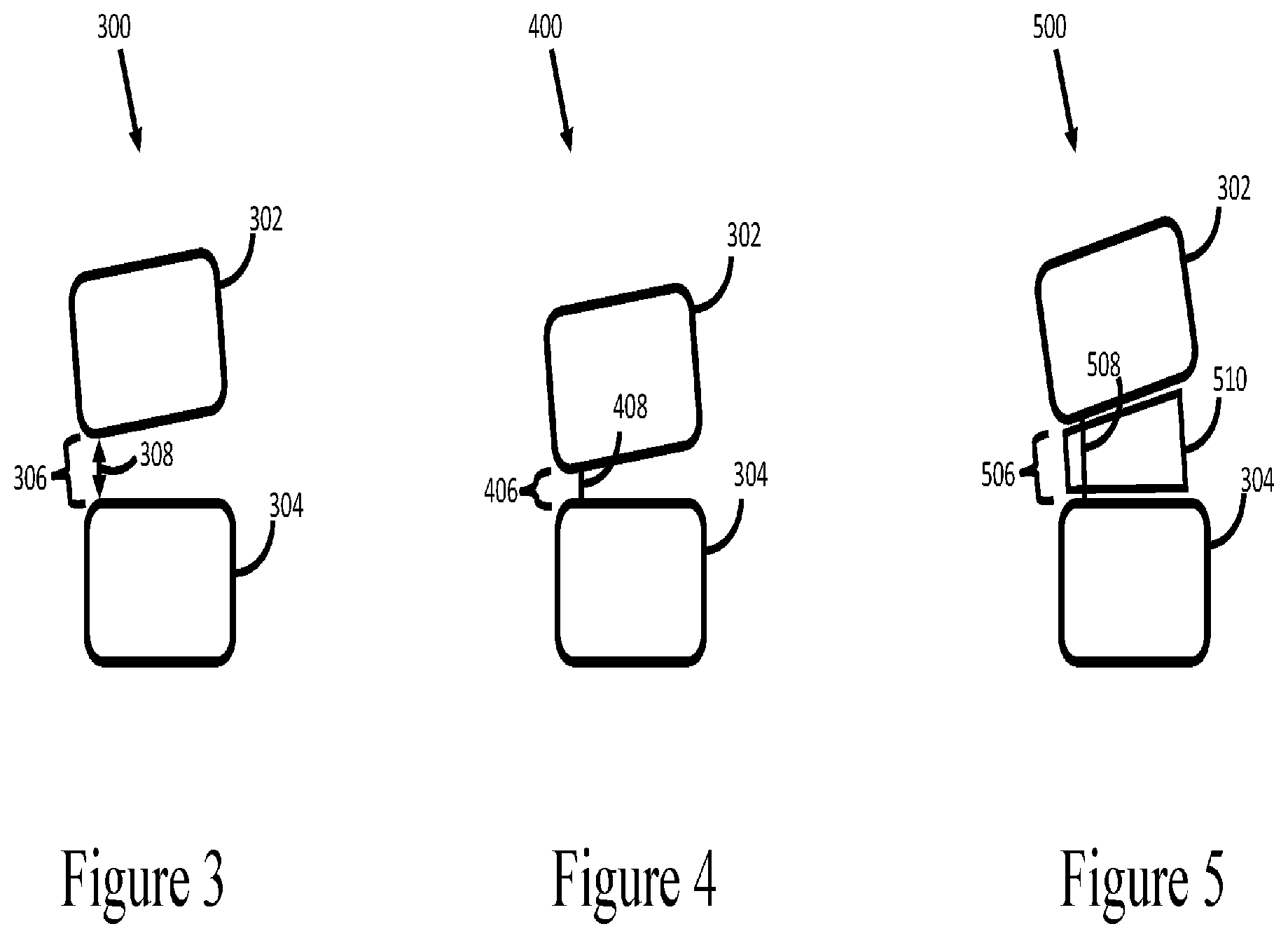 Patent US12426952 Figure 3 – Prediction of postoperative global sagittal alignment based on full-body musculoskeletal modeling and posture optimization