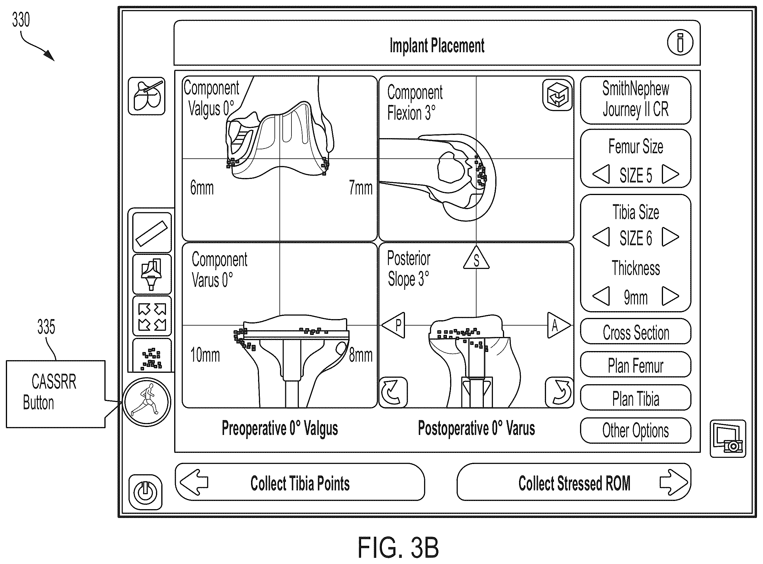 Patent US12426953 Figure 6 – Use of robotic surgical data for training
