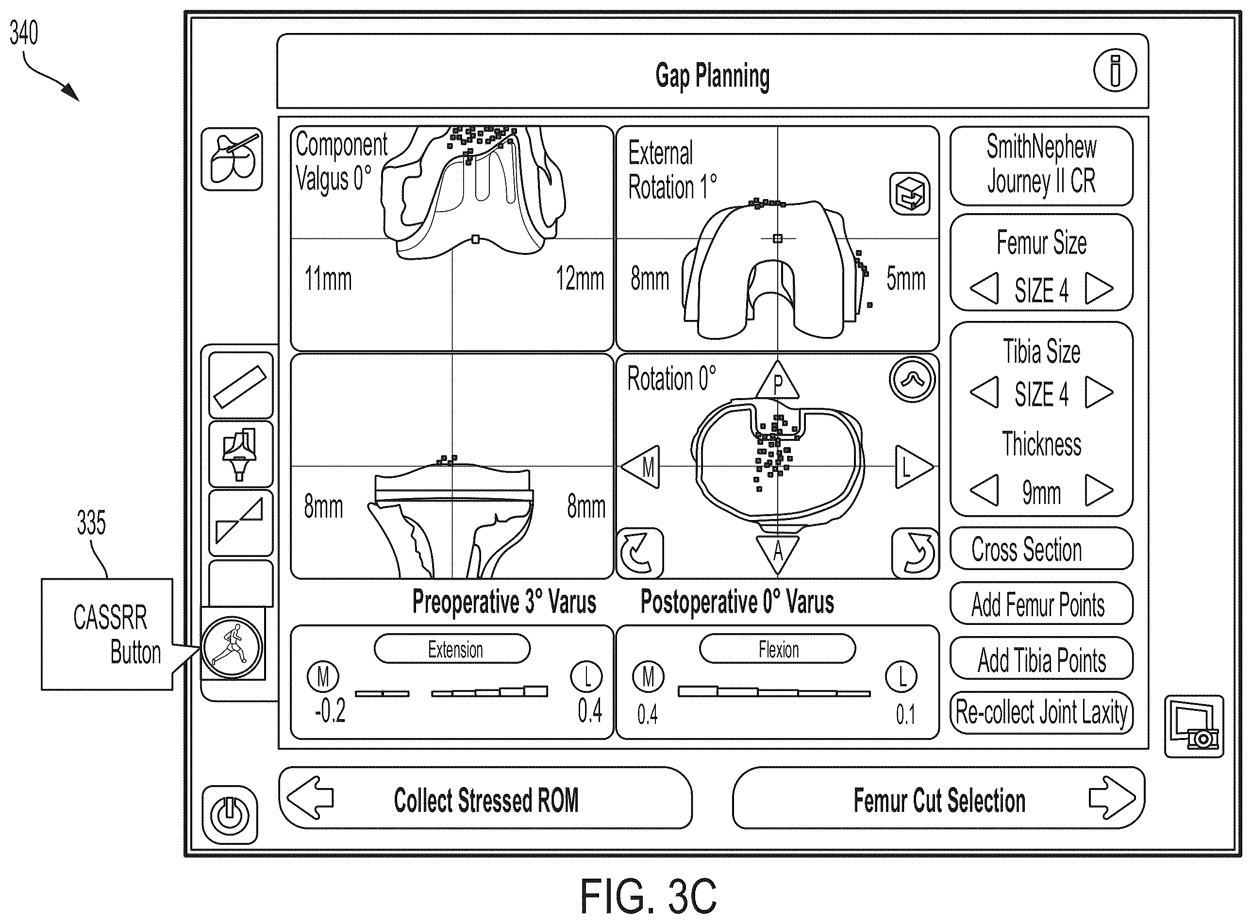 Patent US12426953 Figure 7 – Use of robotic surgical data for training
