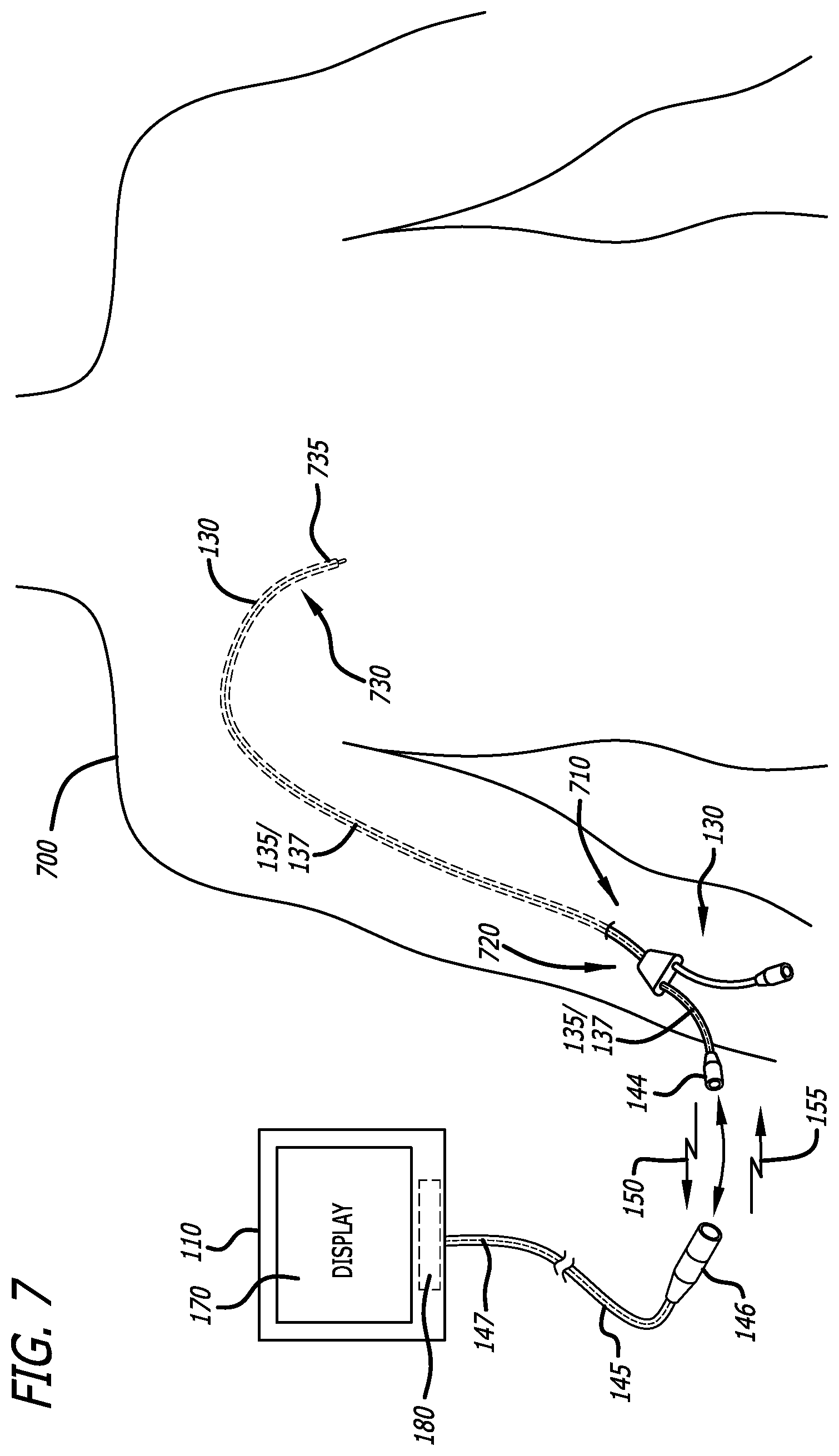 Patent US12426954 Figure 8 – Fiber optic shape sensing system associated with port placement