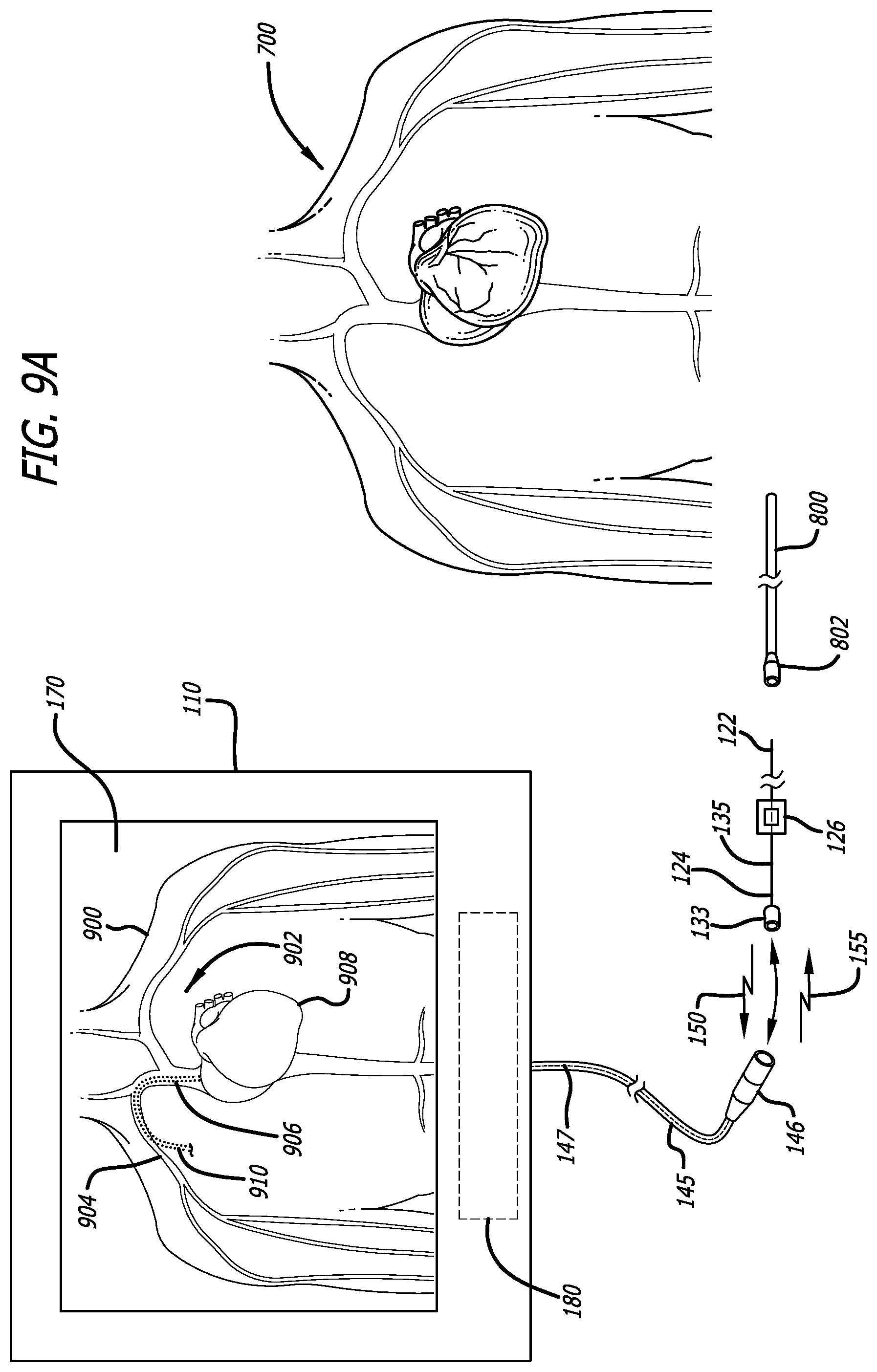 Patent US12426954 Figure 11 – Fiber optic shape sensing system associated with port placement