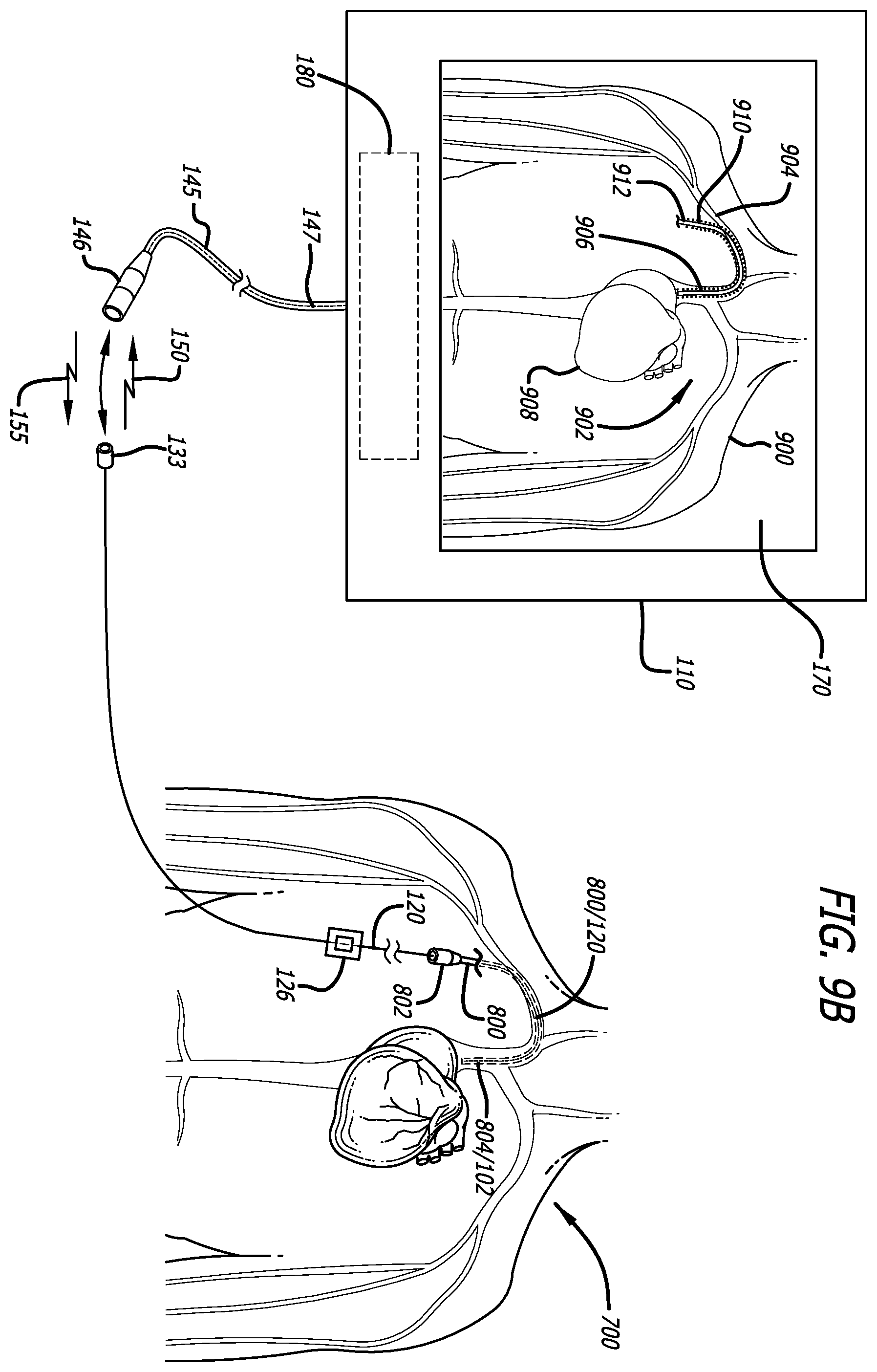 Patent US12426954 Figure 12 – Fiber optic shape sensing system associated with port placement