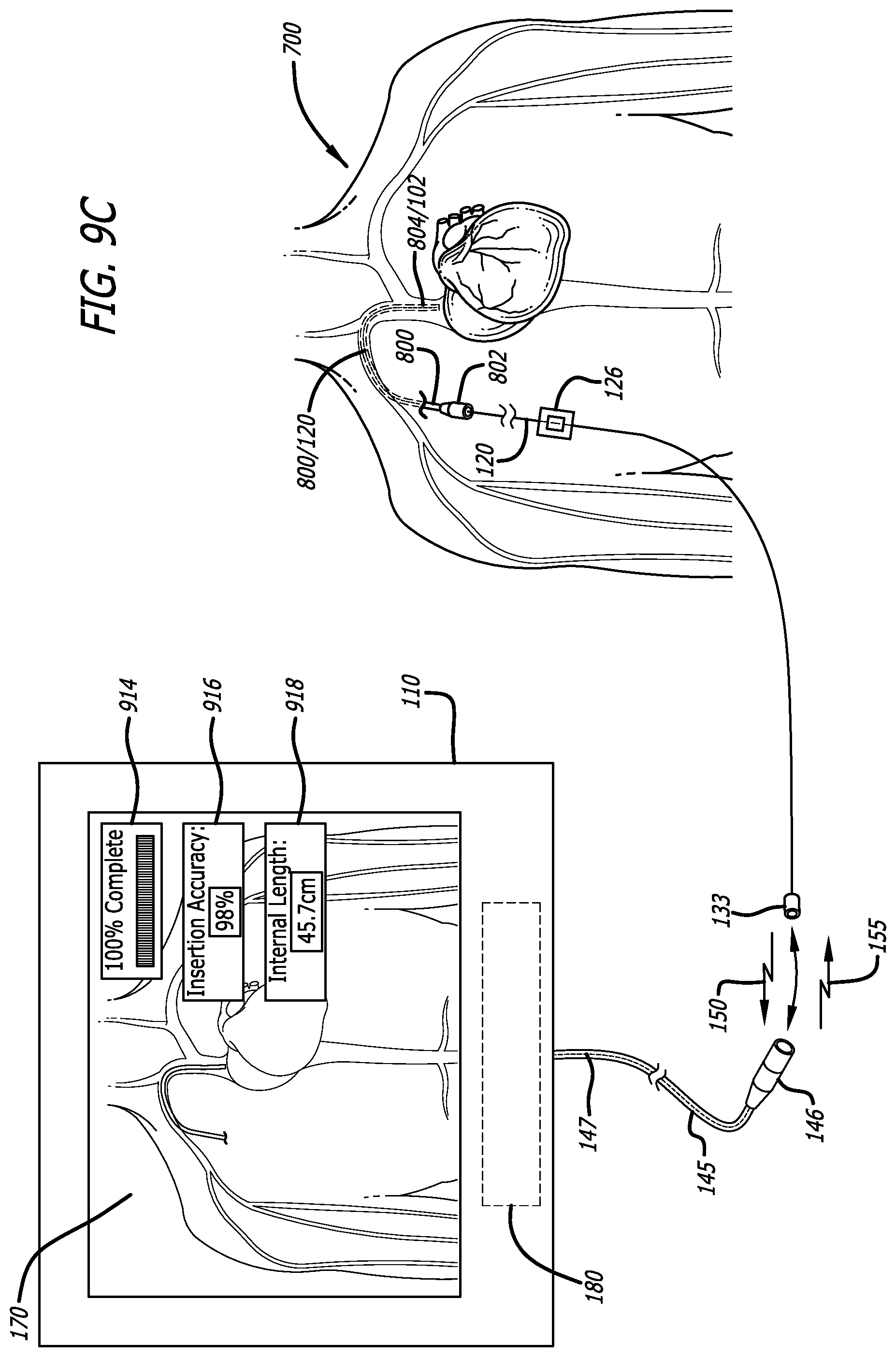 Patent US12426954 Figure 13 – Fiber optic shape sensing system associated with port placement