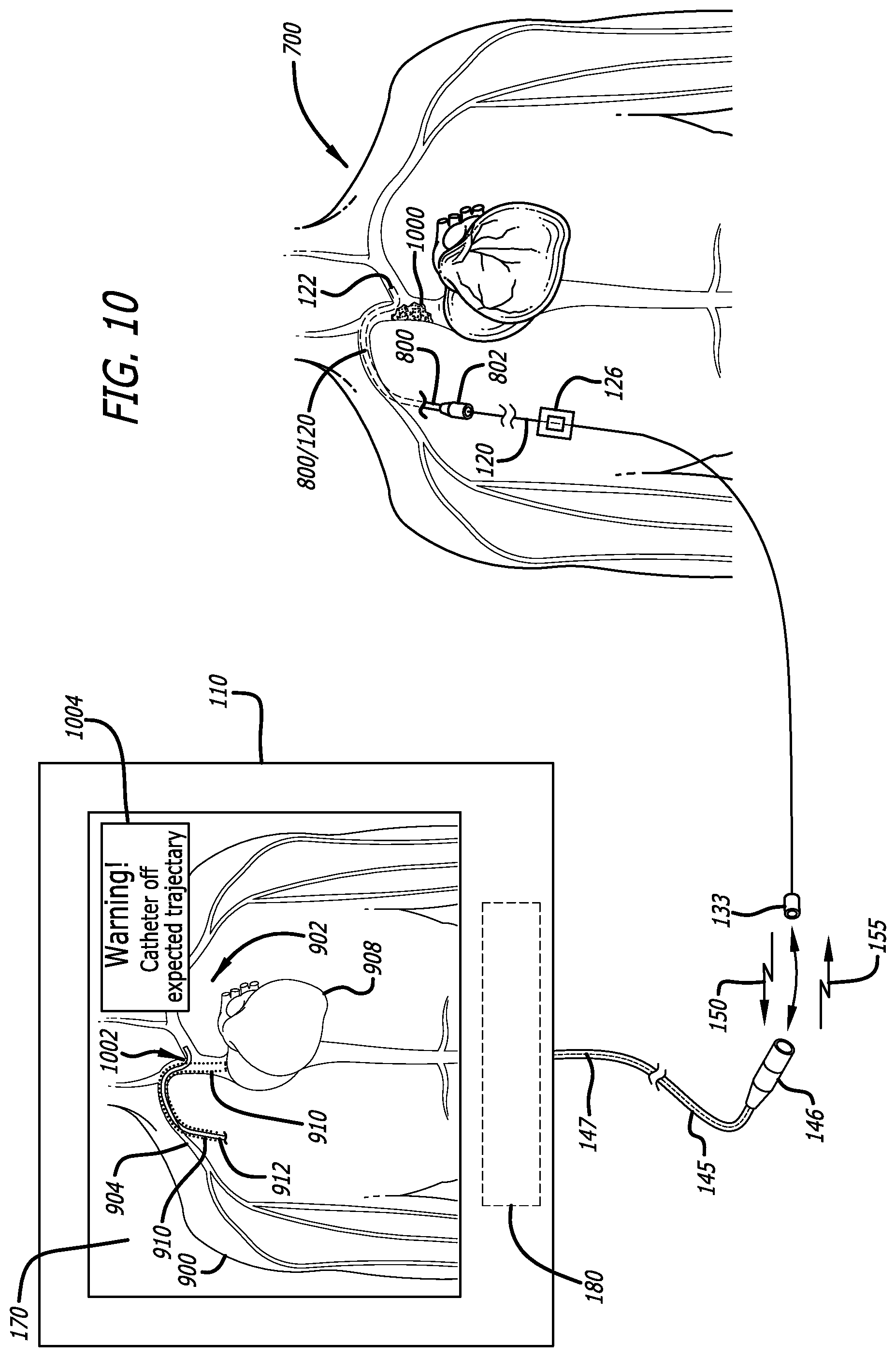 Patent US12426954 Figure 14 – Fiber optic shape sensing system associated with port placement