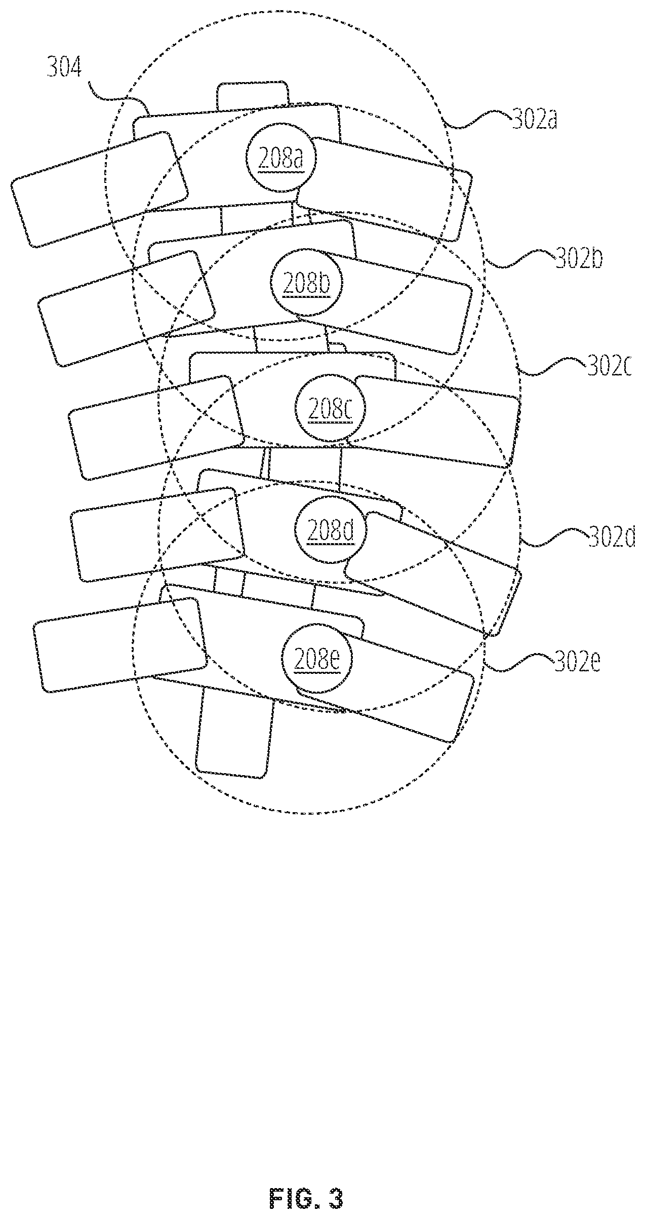 Patent US12426955 Figure 4 – Systems and methods for improved electromagnetic tracking